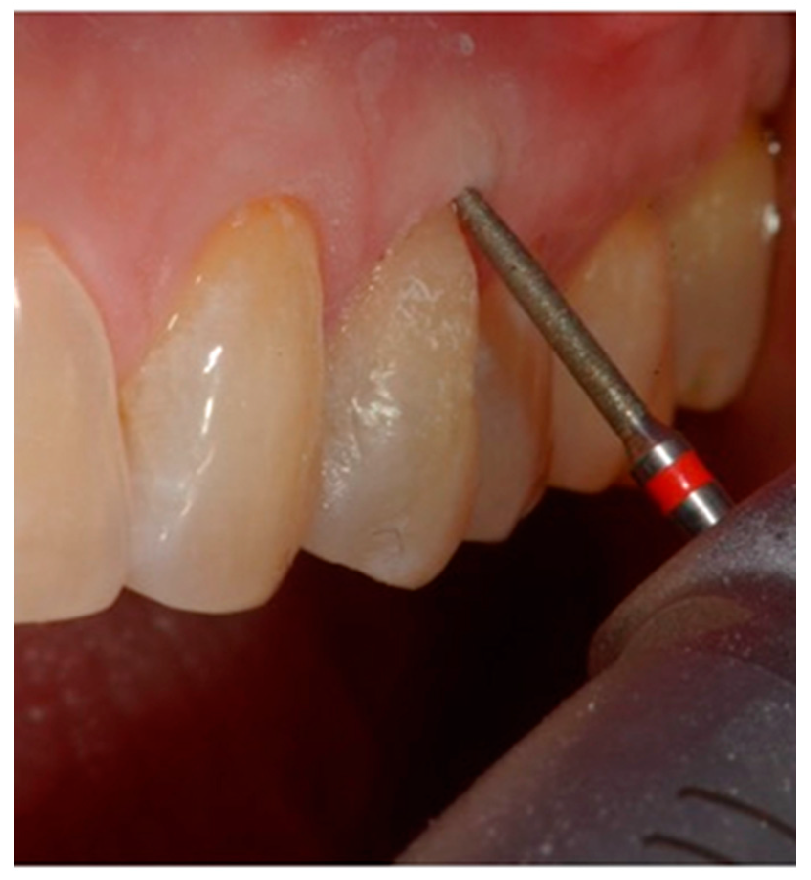 Dentistry 10 00132 g008 Dentistry 10 00132 g008