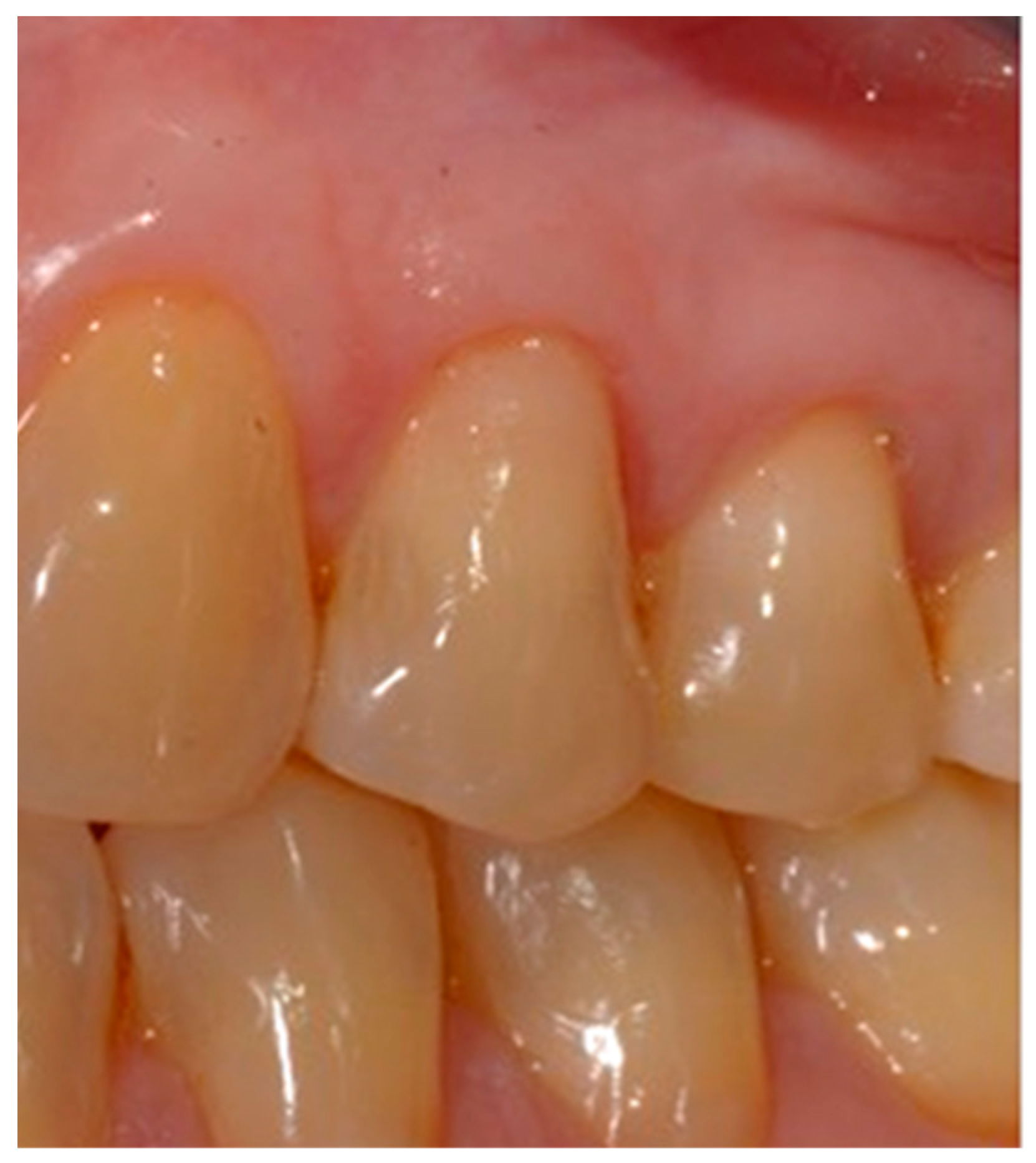 Dentistry 10 00132 g010 Dentistry 10 00132 g010