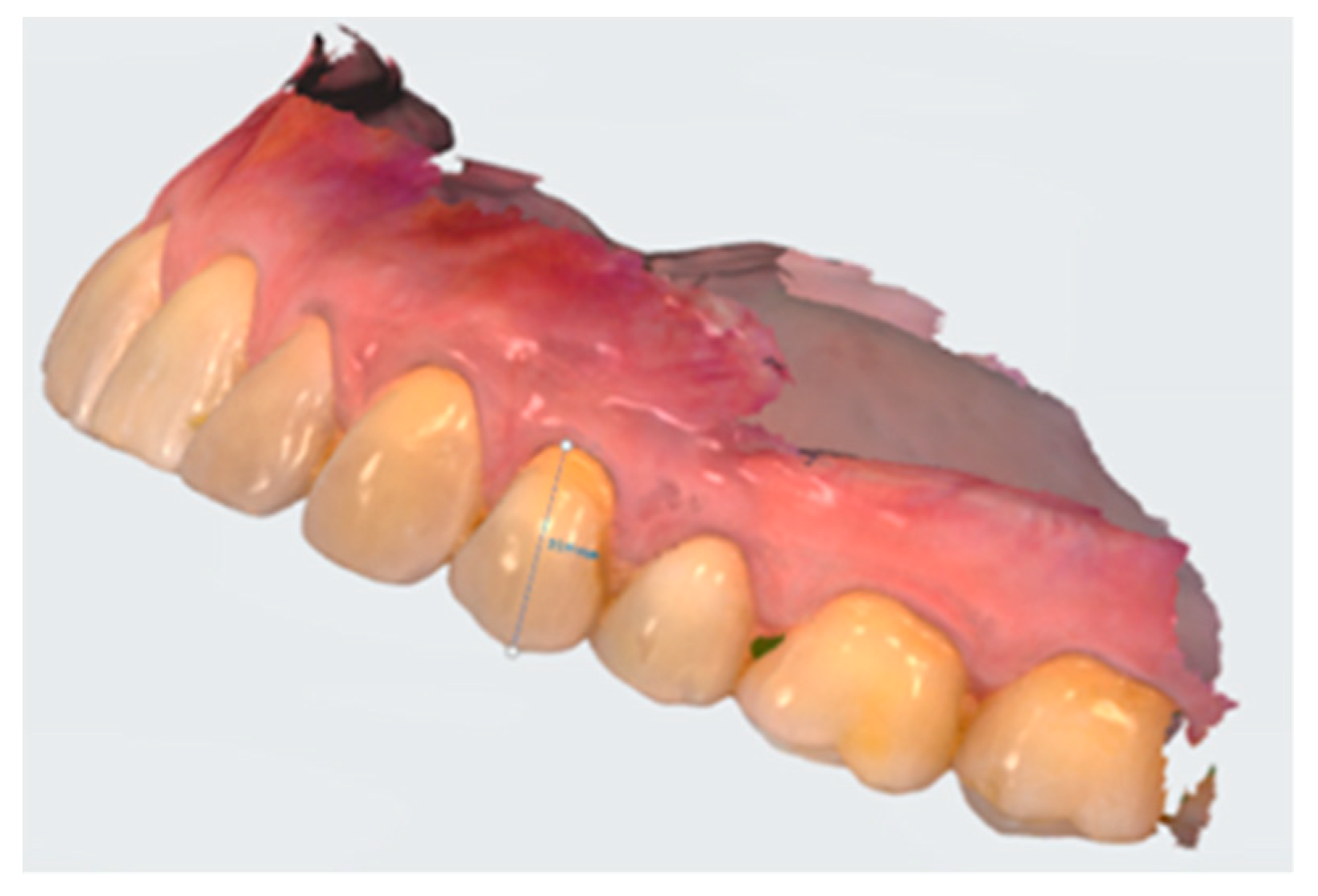 Dentistry 10 00132 g011 Dentistry 10 00132 g011