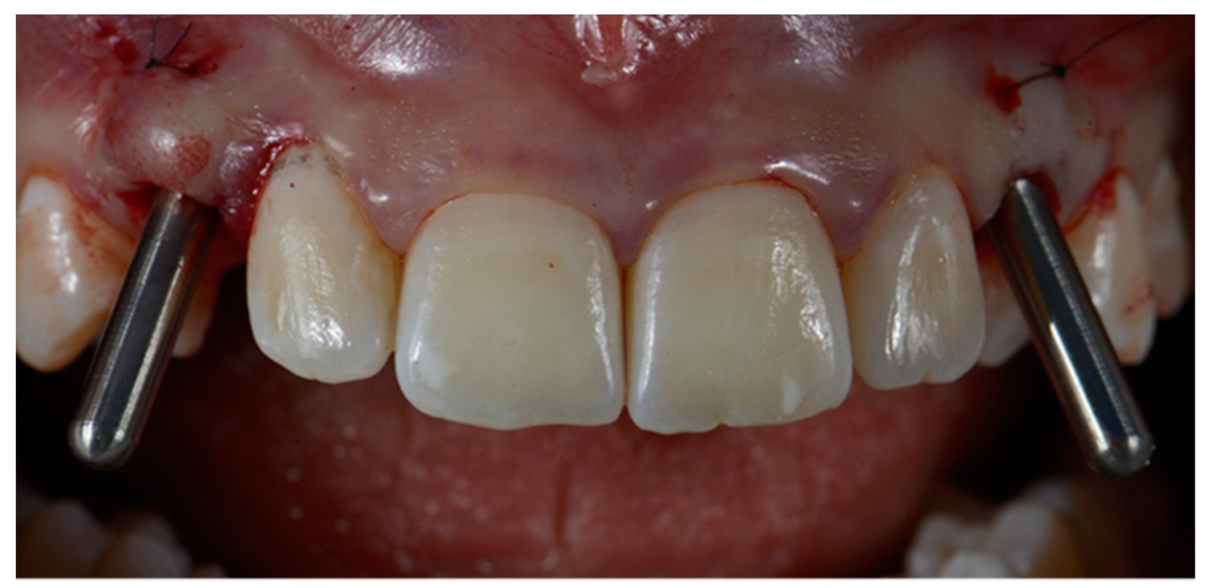 Dentistry 10 00139 g004 550