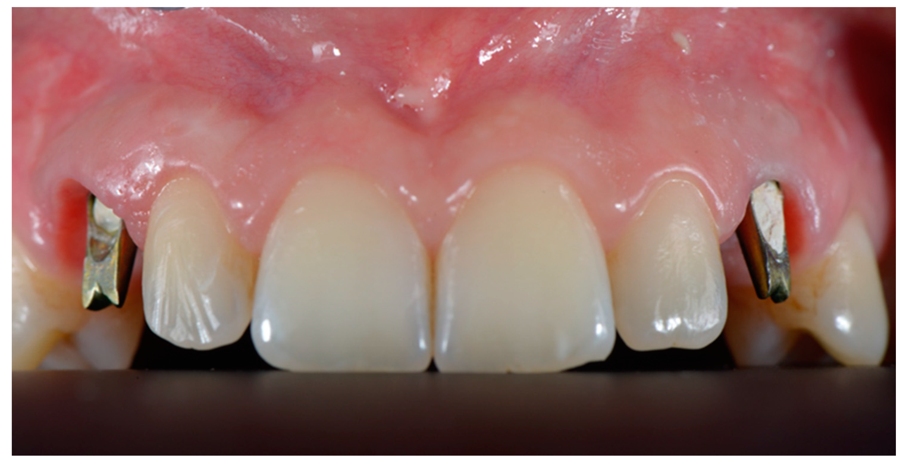 Dentistry 10 00139 g005 550