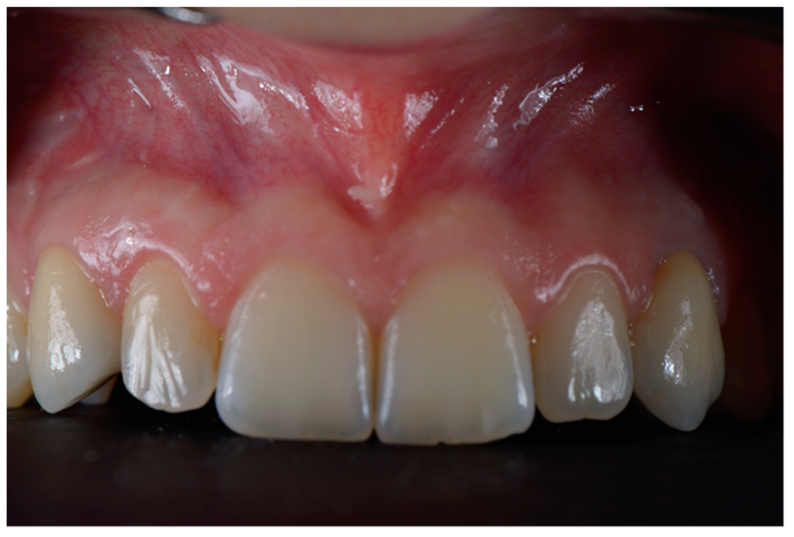 Dentistry 10 00139 g007 550