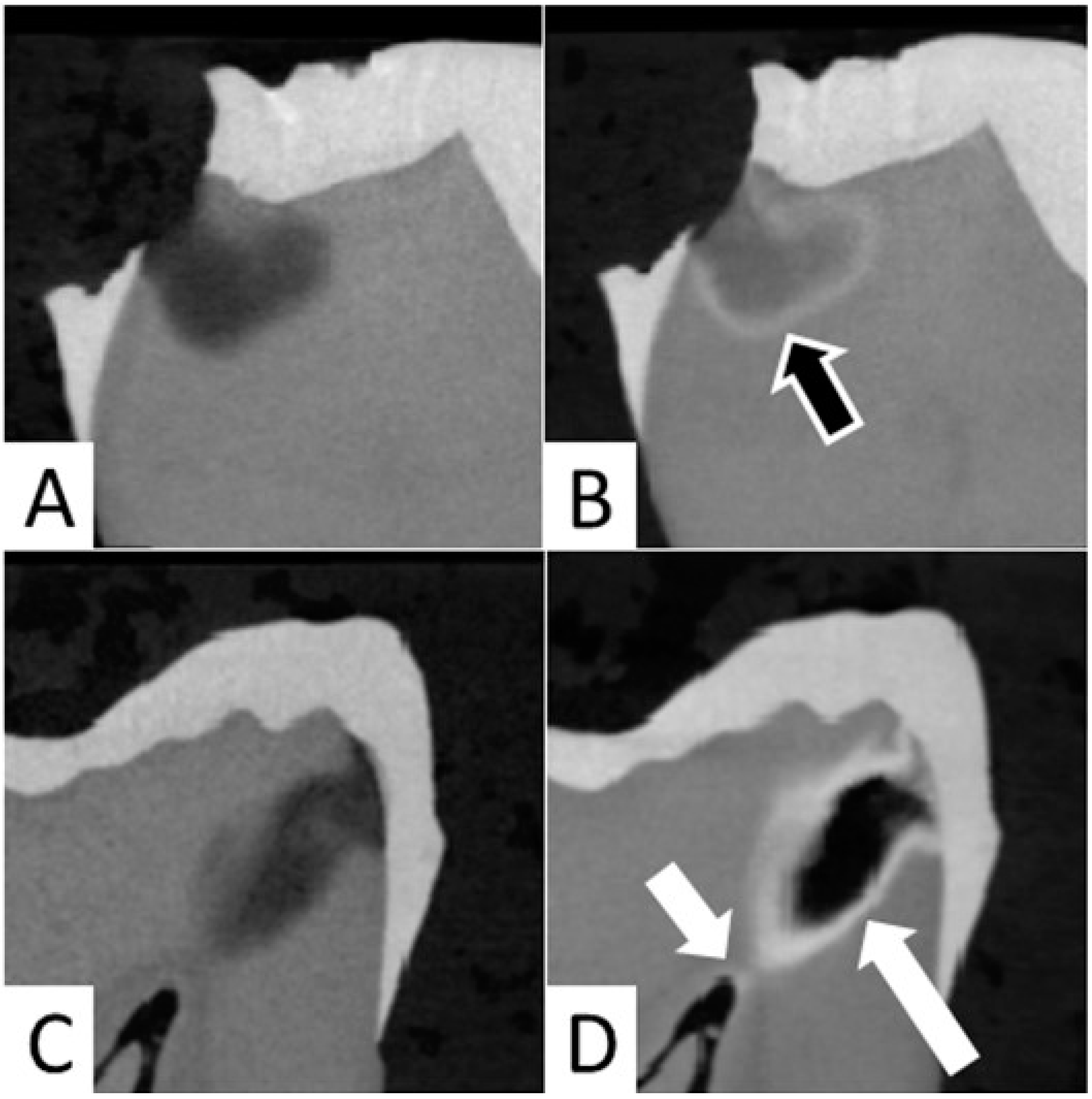 Dentistry 10 00149 g004 550