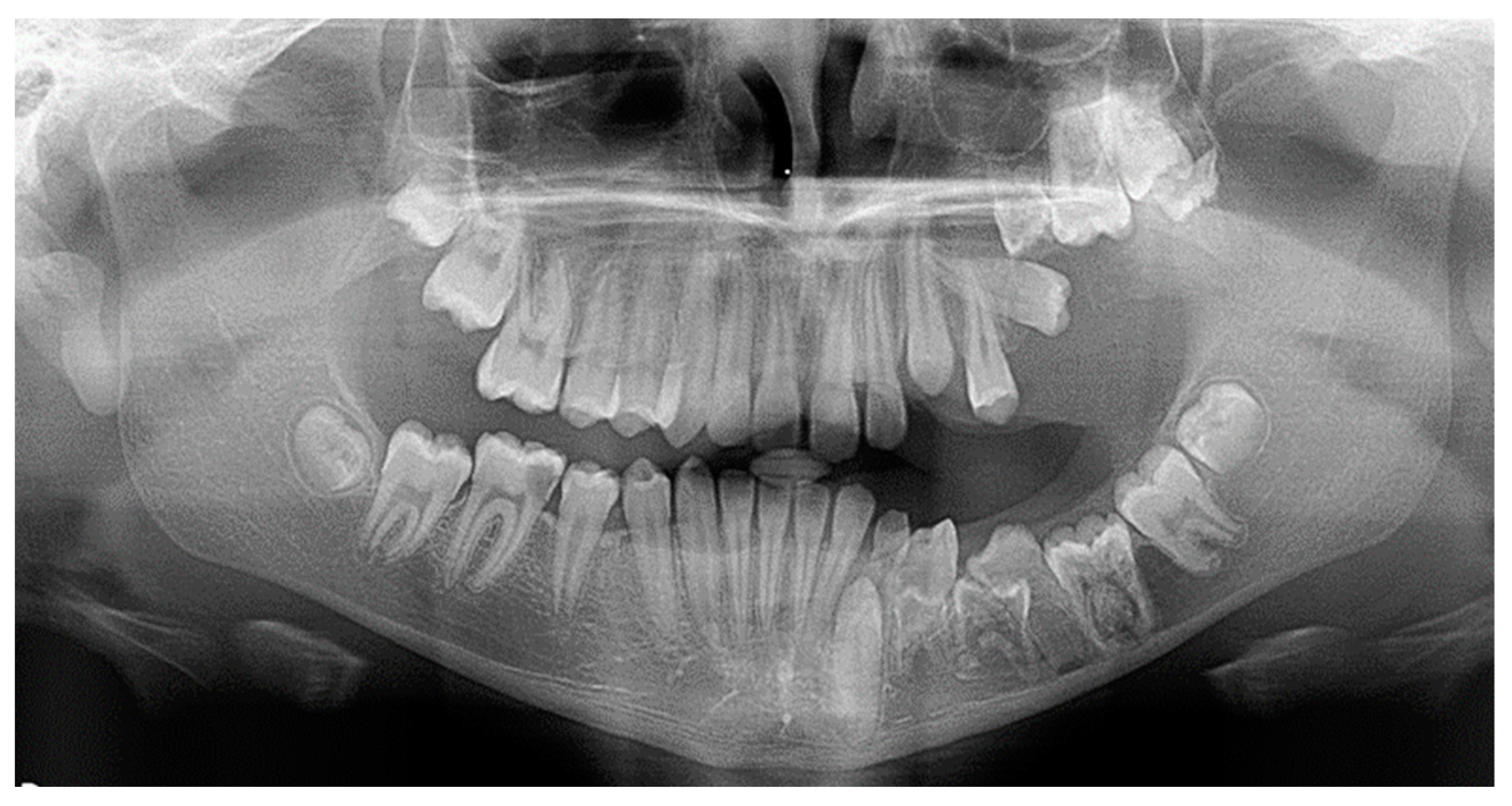 Dentistry 10 00150 g001 550