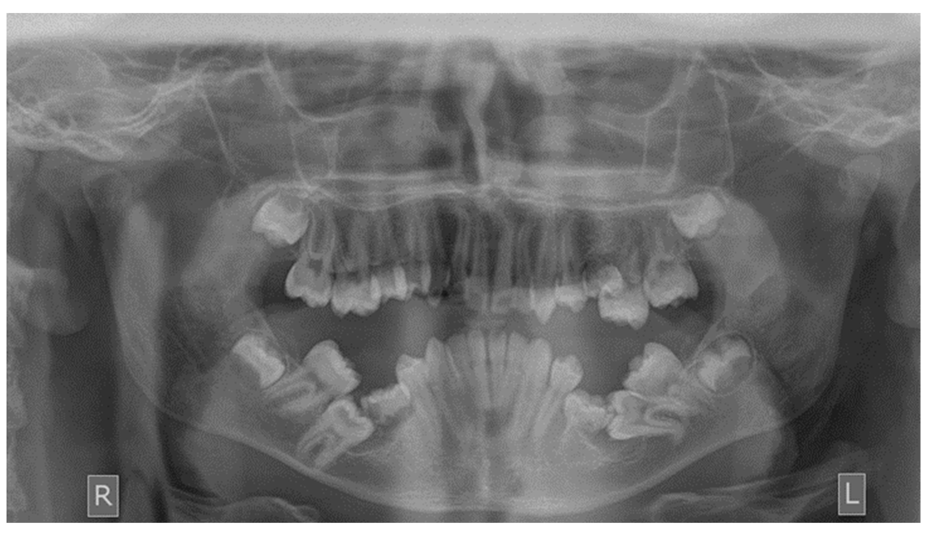 Dentistry 10 00150 g002 550