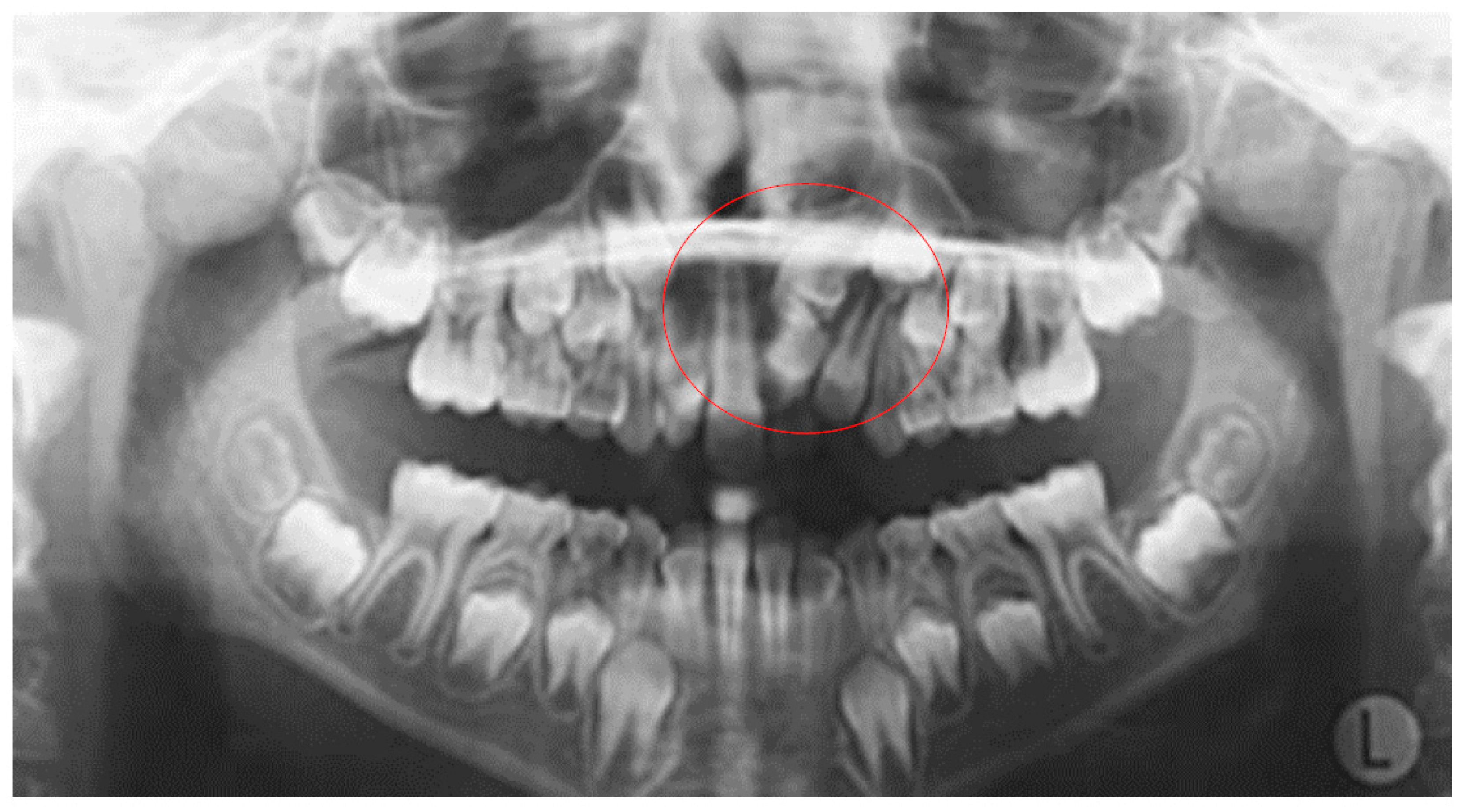 Dentistry 10 00150 g004 550