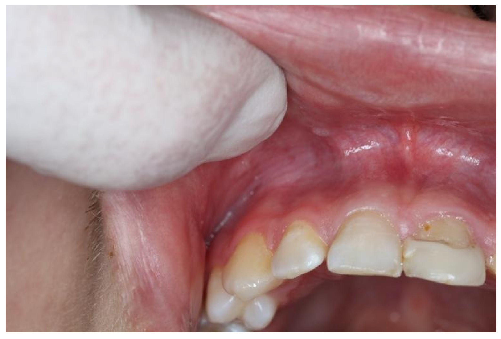 Dentistry 10 00154 g004