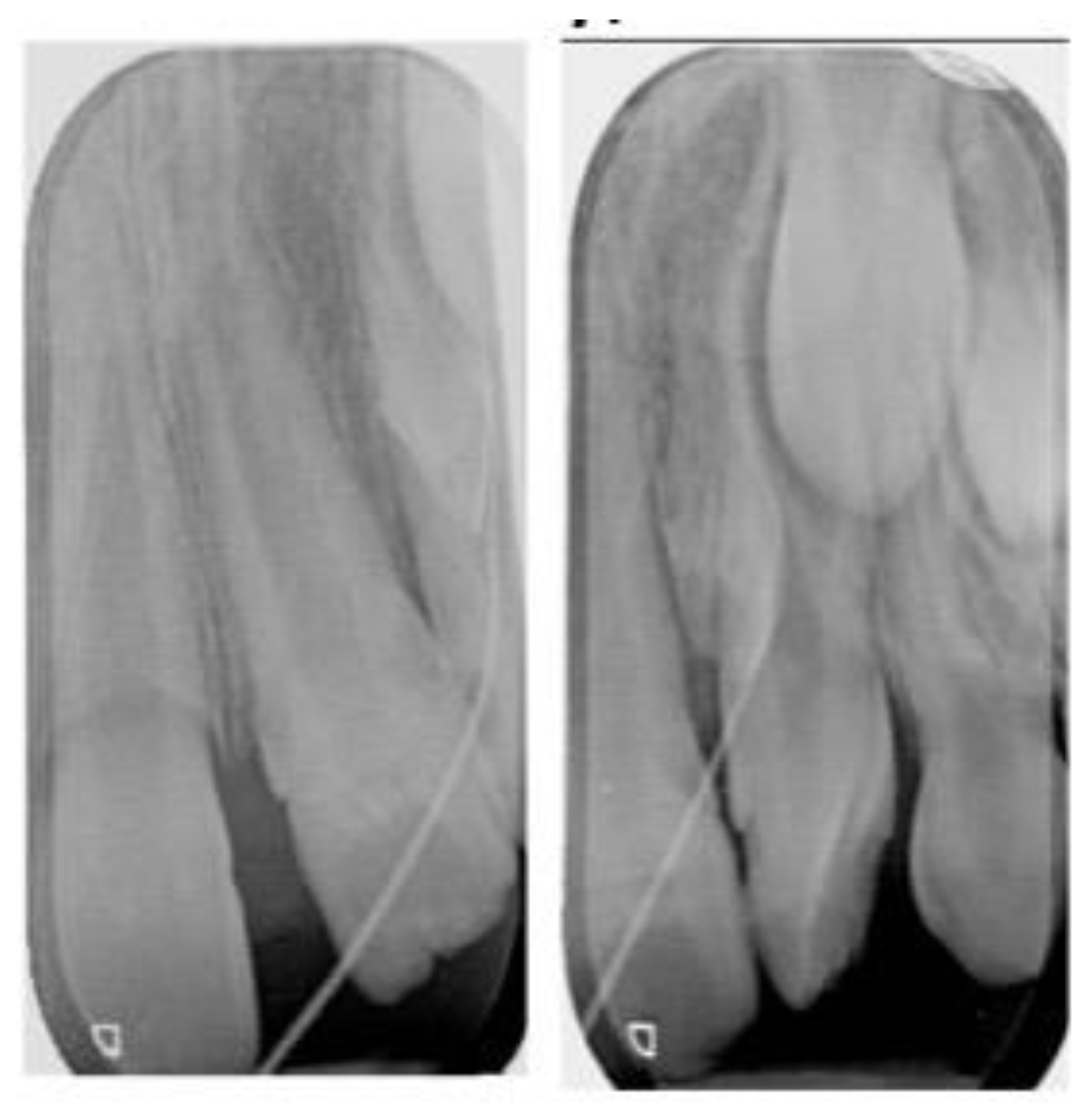 Dentistry 10 00202 g002 Dentistry 10 00202 g002