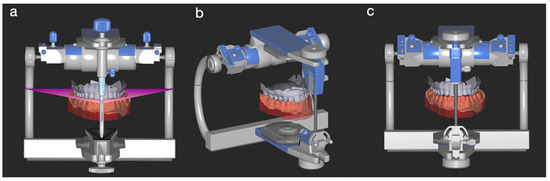 Assessment of Occlusal Vertical Dimension Change in Mechanical and
