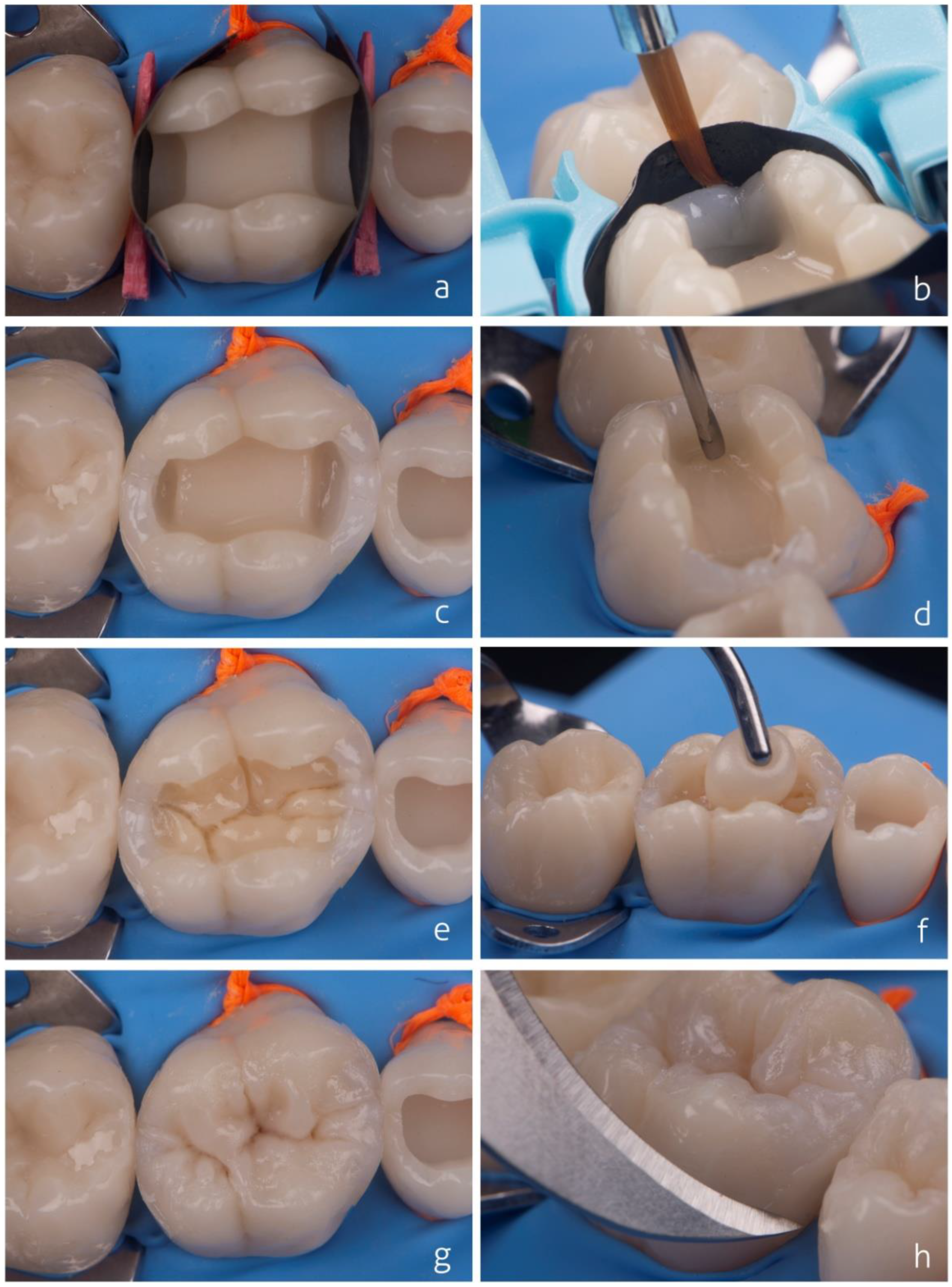 Dentistry 10 00222 g006 Dentistry 10 00222 g006