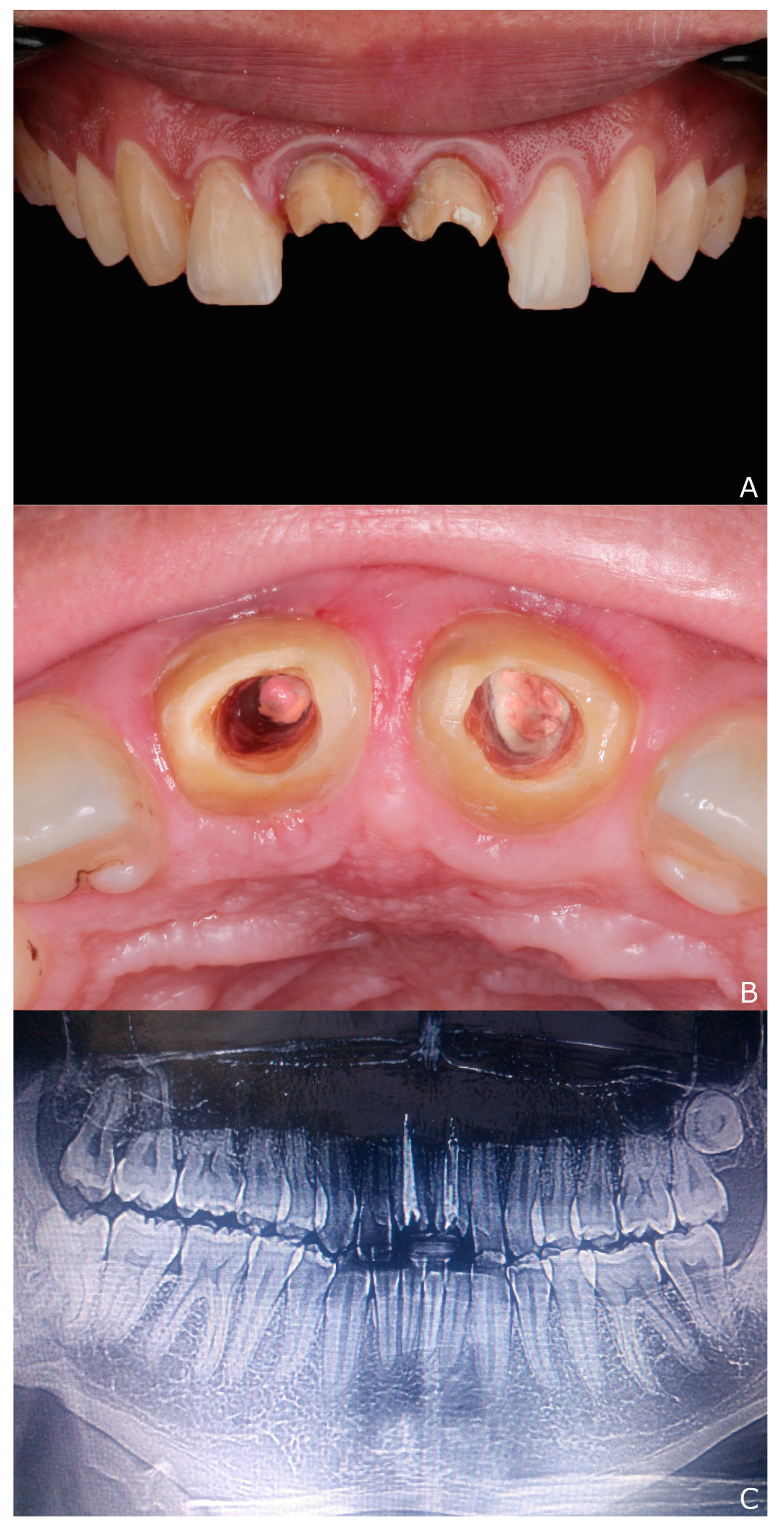 Dentistry 10 00237 g002 Dentistry 10 00237 g002
