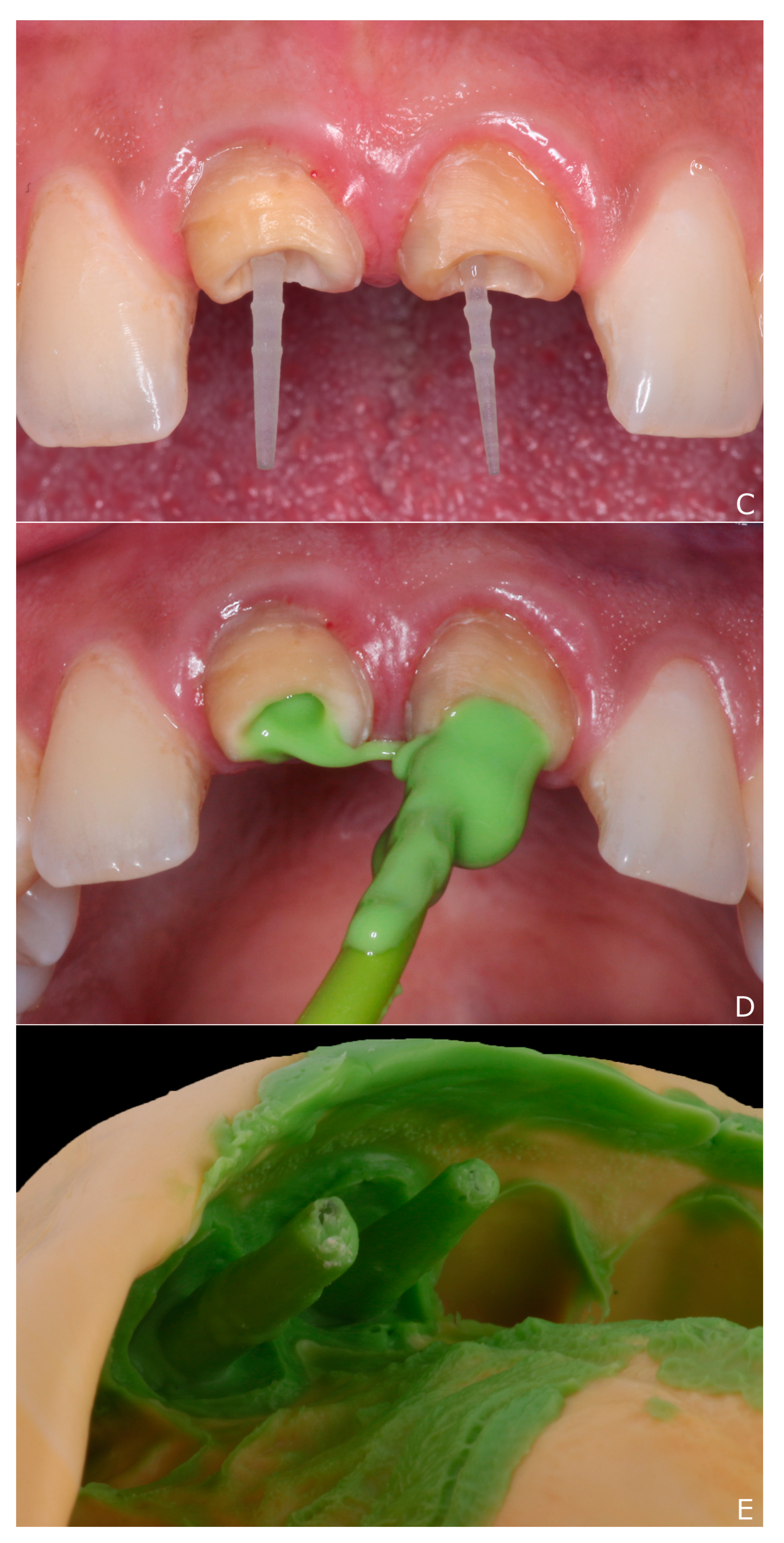 Dentistry 10 00237 g003b Dentistry 10 00237 g003b