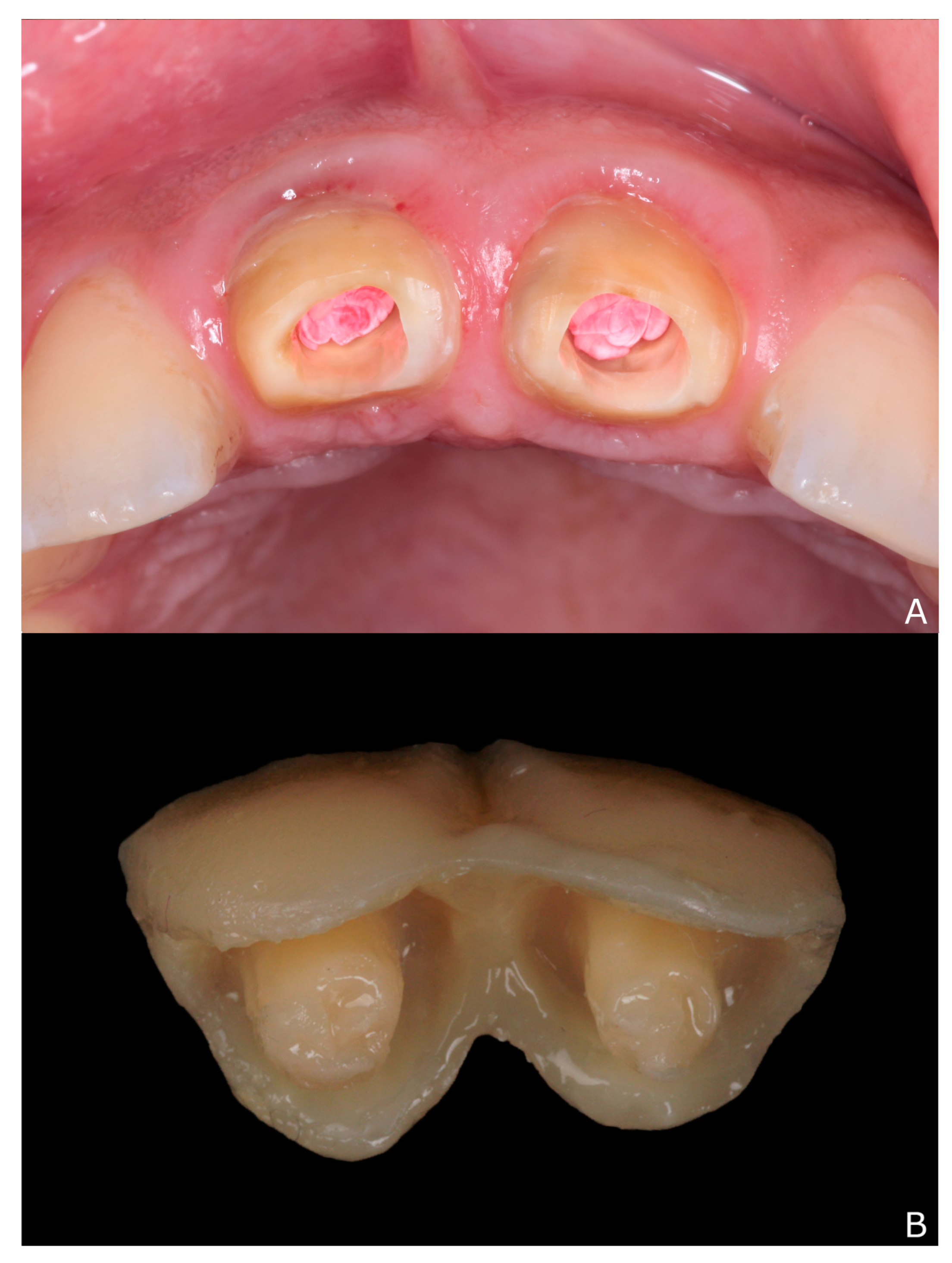 Dentistry 10 00237 g004 Dentistry 10 00237 g004