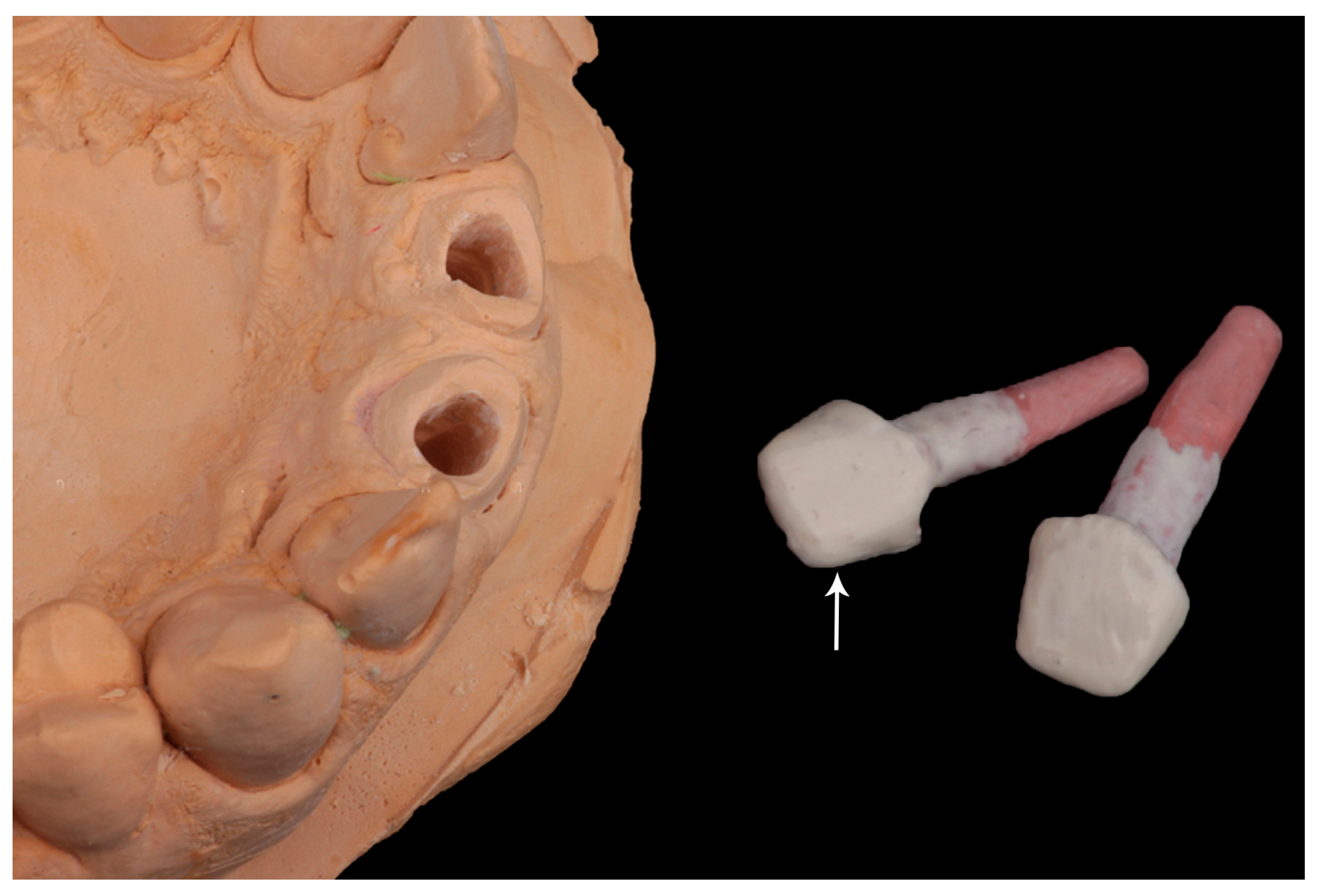 Dentistry 10 00237 g005 Dentistry 10 00237 g005