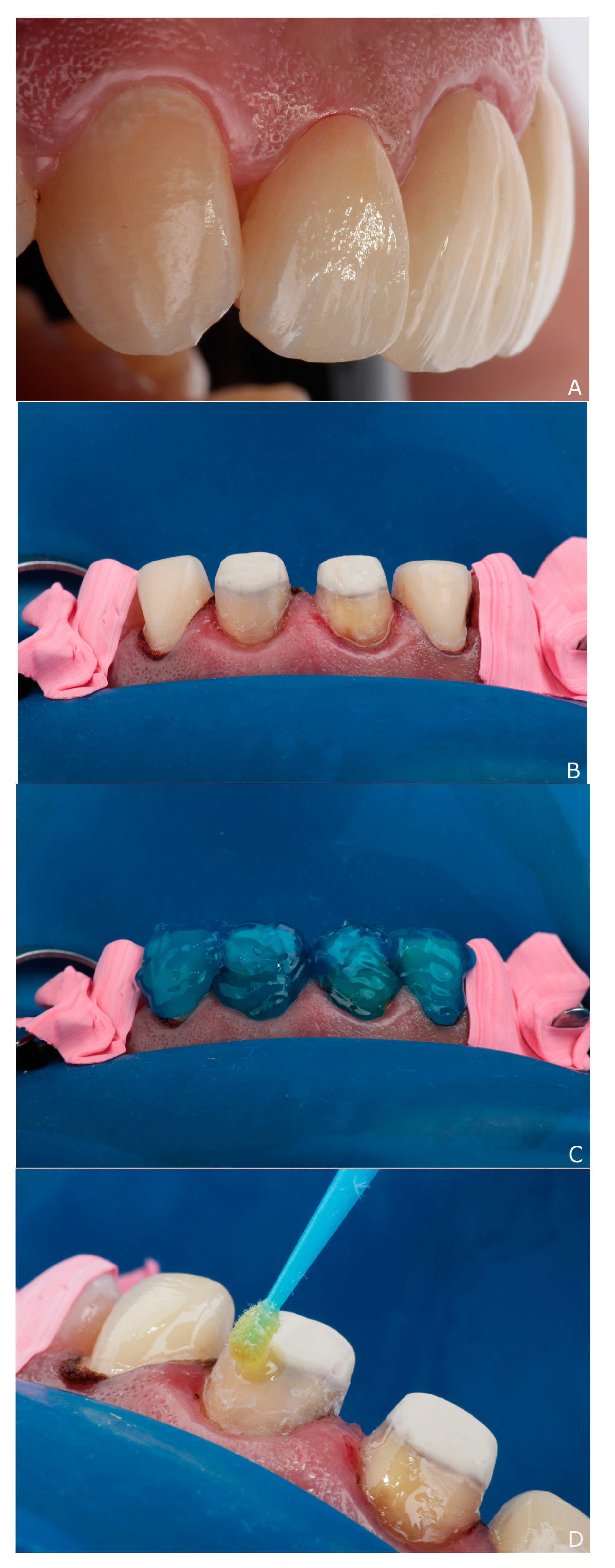 Dentistry 10 00237 g007 Dentistry 10 00237 g007