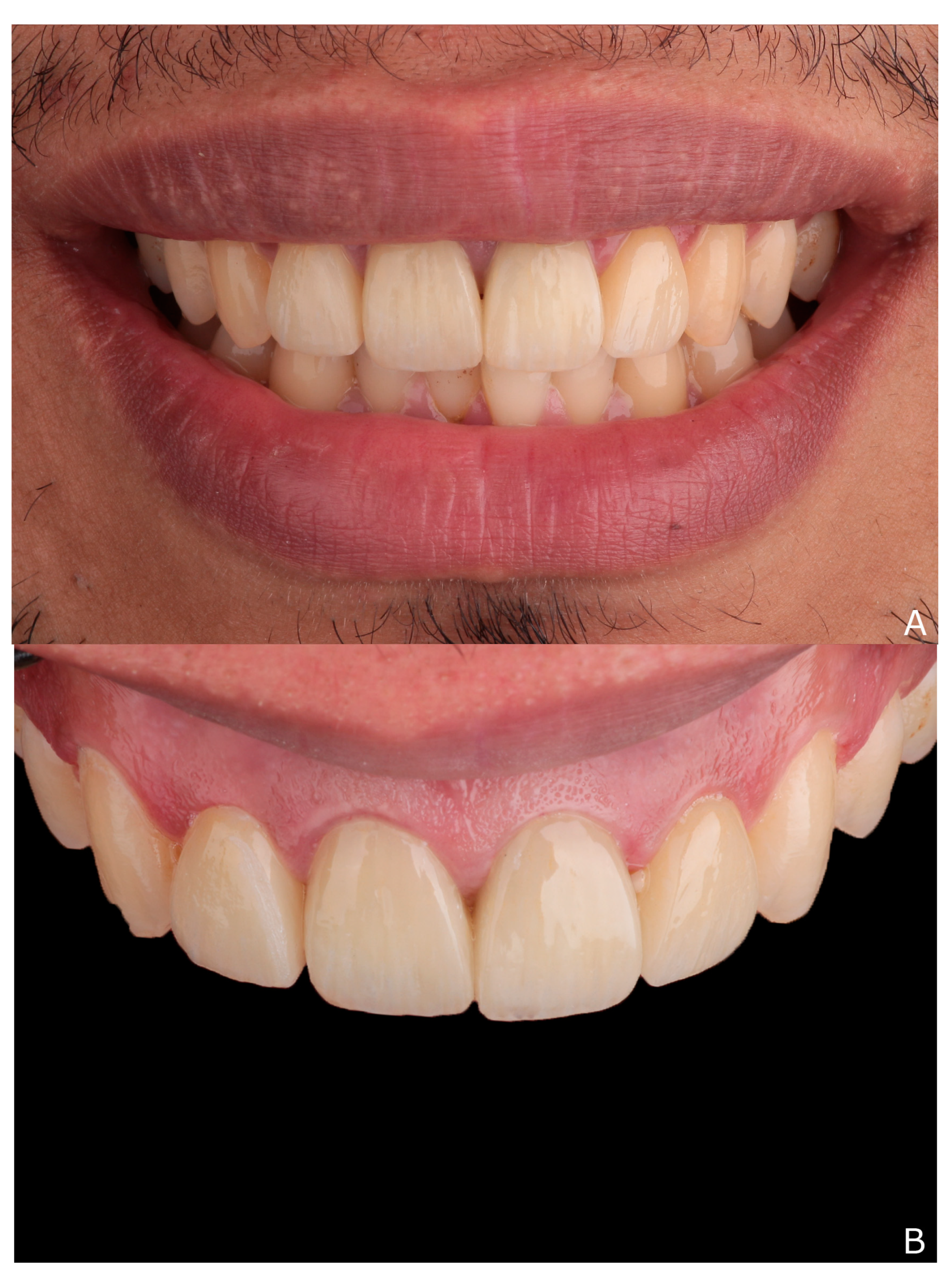 Dentistry 10 00237 g008a Dentistry 10 00237 g008a