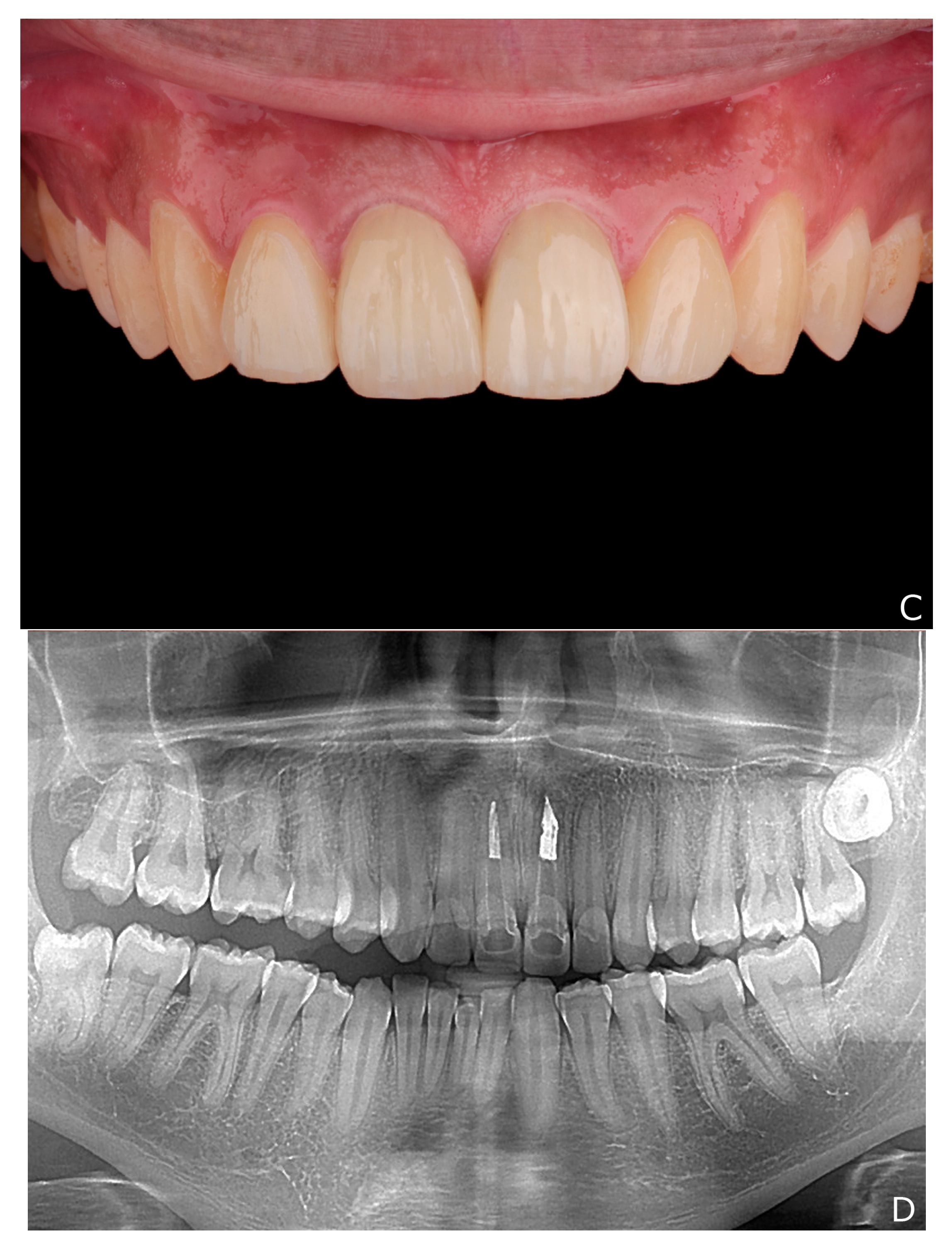 Dentistry 10 00237 g008b Dentistry 10 00237 g008b