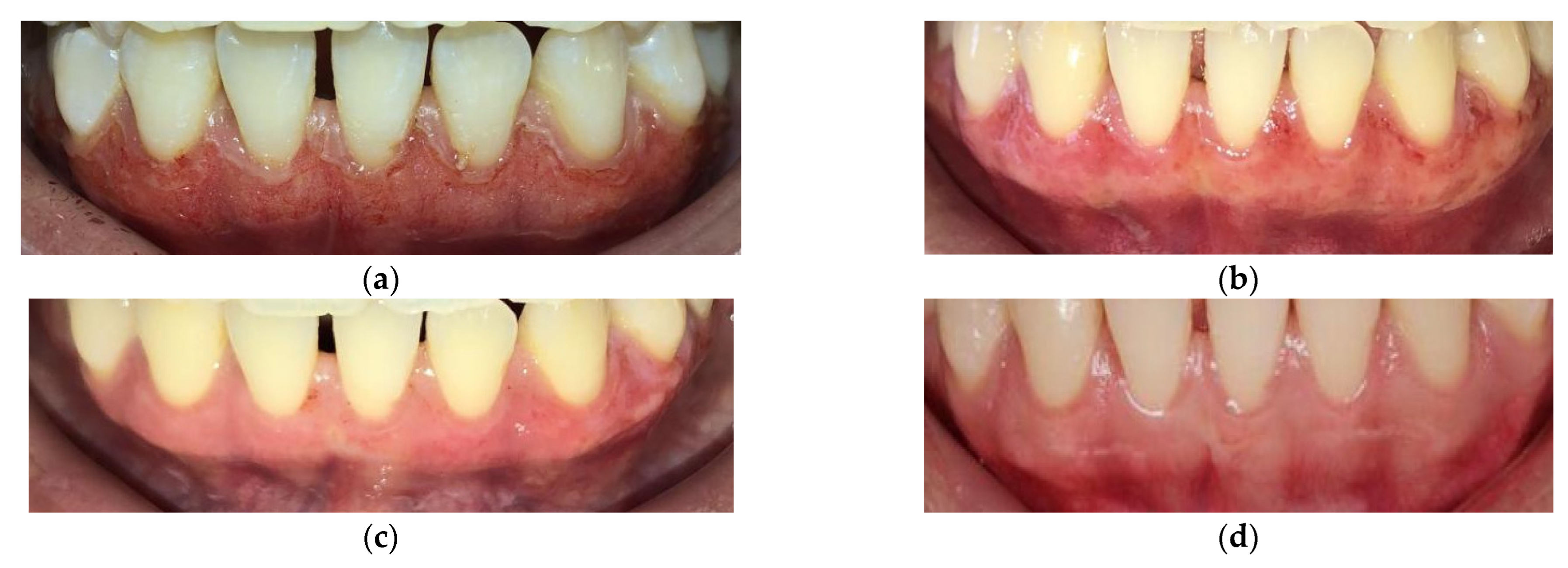 Dentistry 10 00238 g001 Dentistry 10 00238 g001