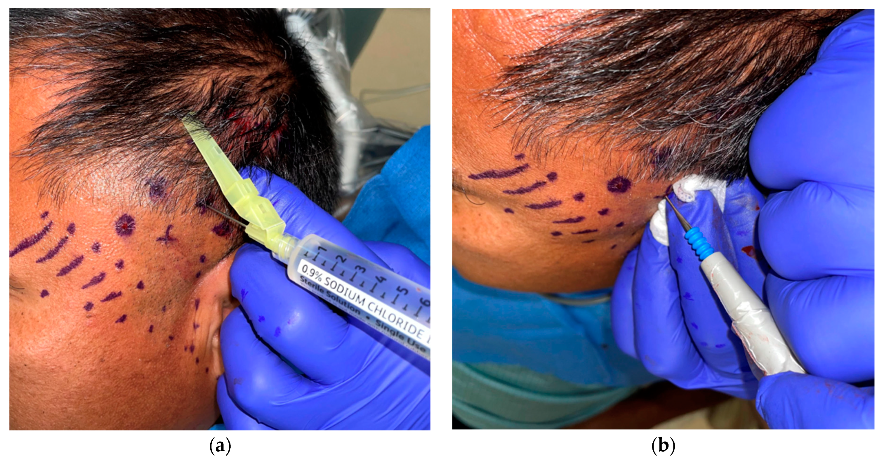 Dentistry 11 00003 g003