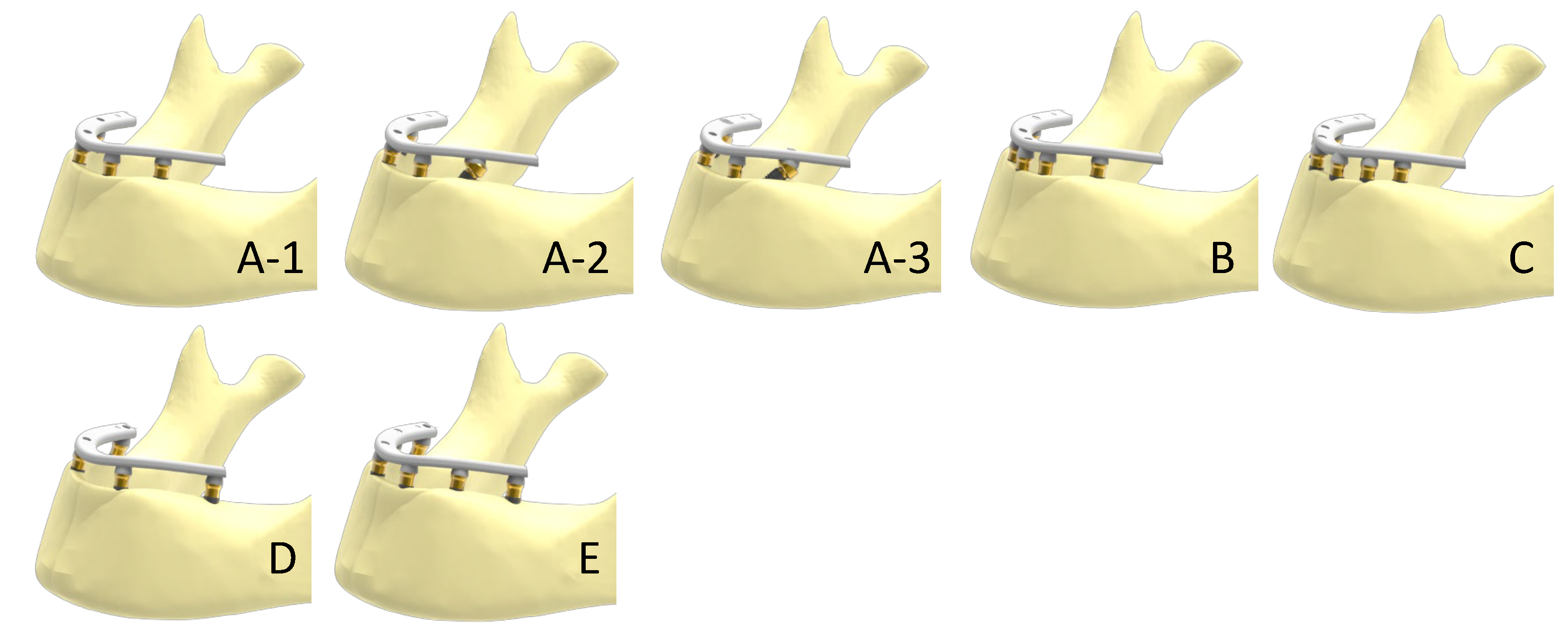Dentistry 11 00004 g001