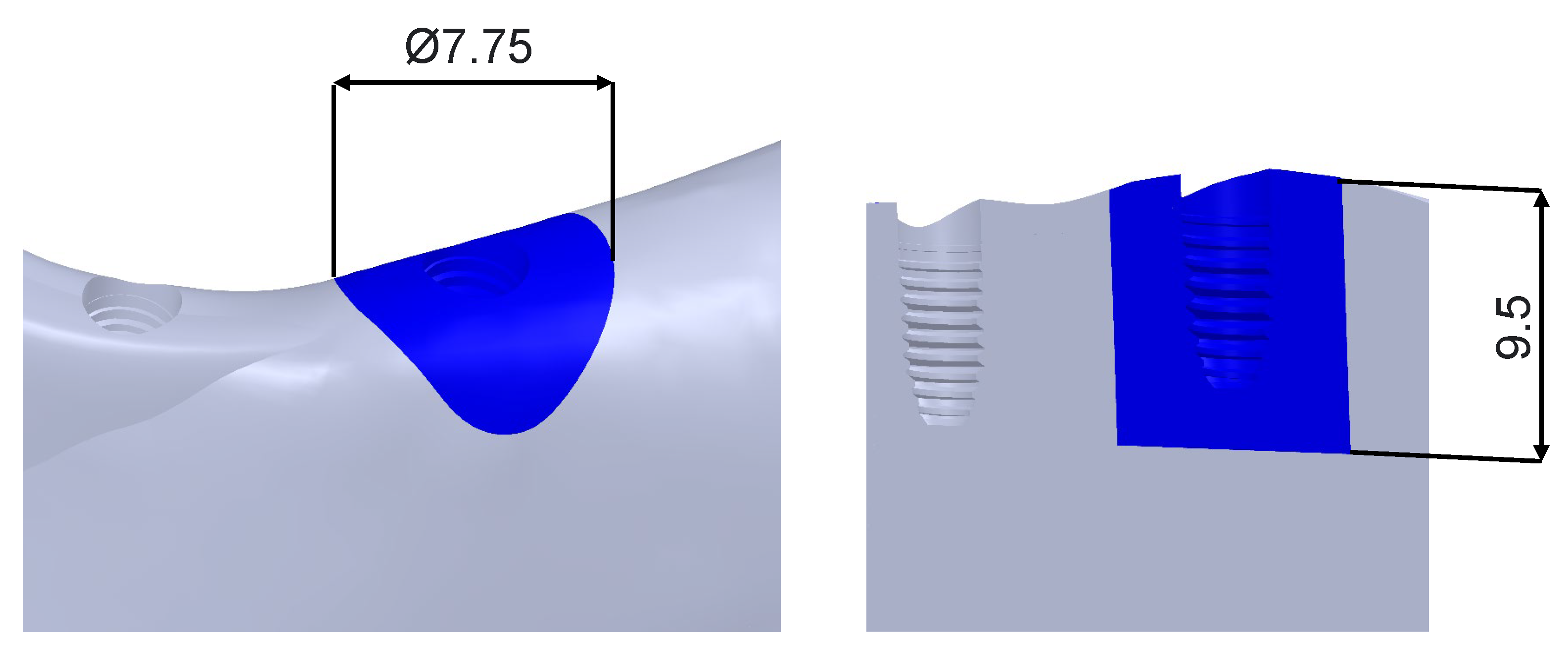 Dentistry 11 00004 g007