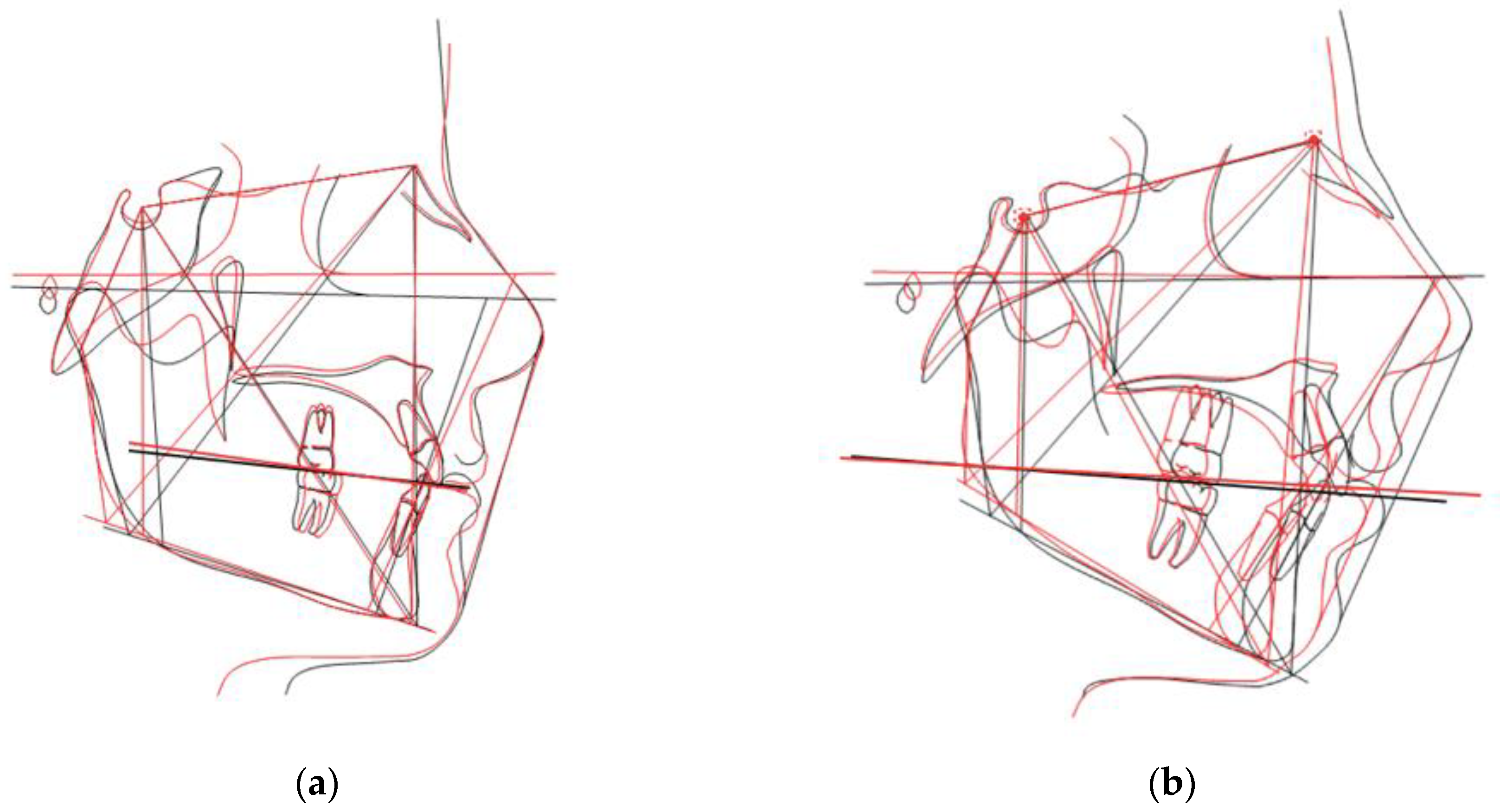 Dentistry 11 00008 g003 Dentistry 11 00008 g003