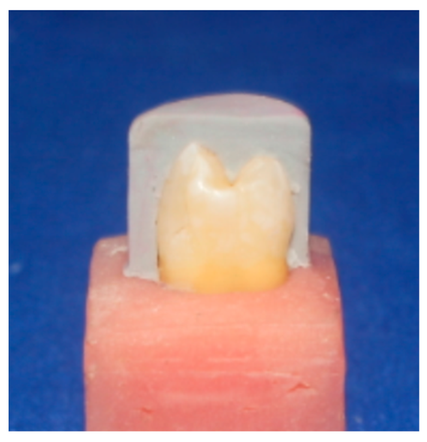 Dentistry 11 00012 g001 Dentistry 11 00012 g001