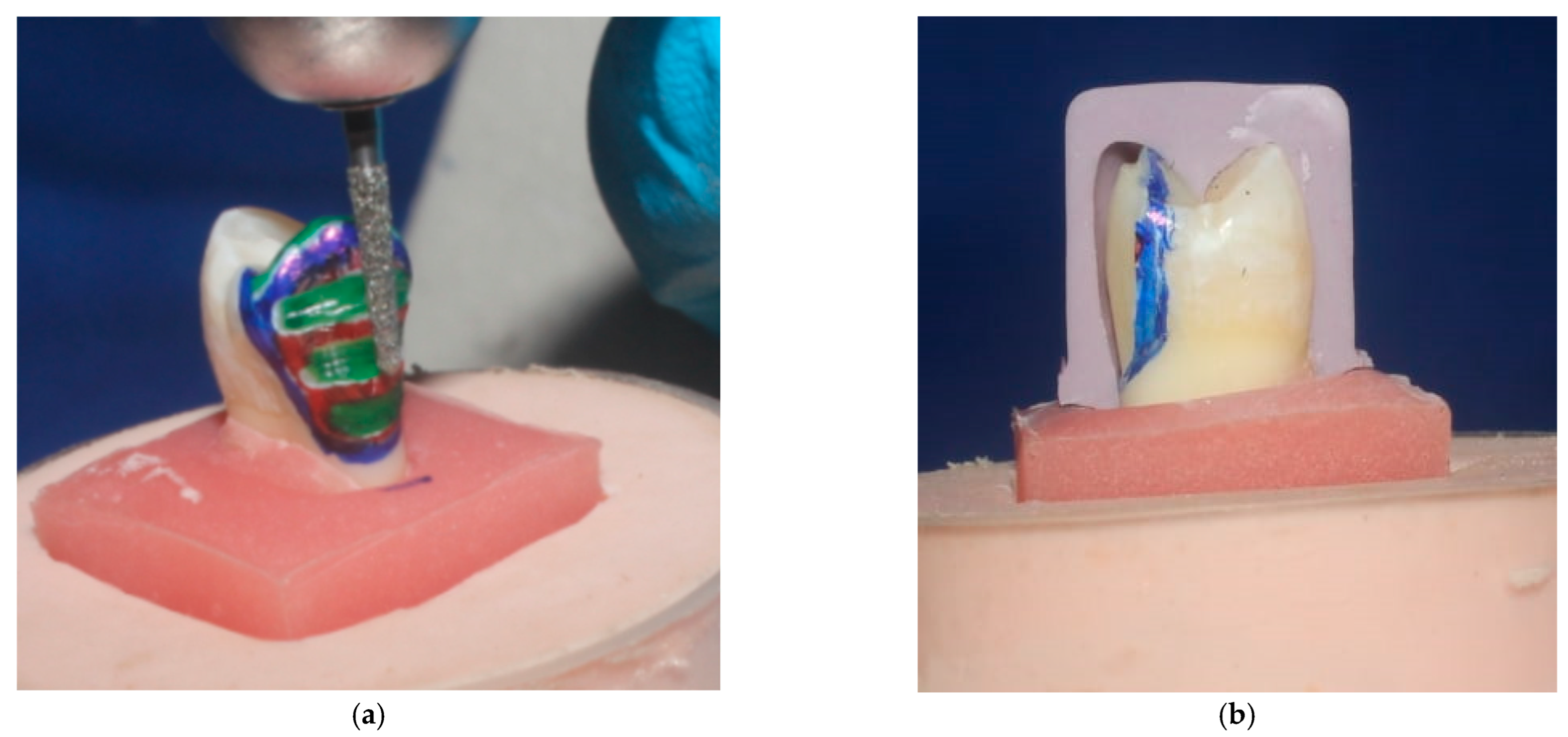 Dentistry 11 00012 g002 Dentistry 11 00012 g002
