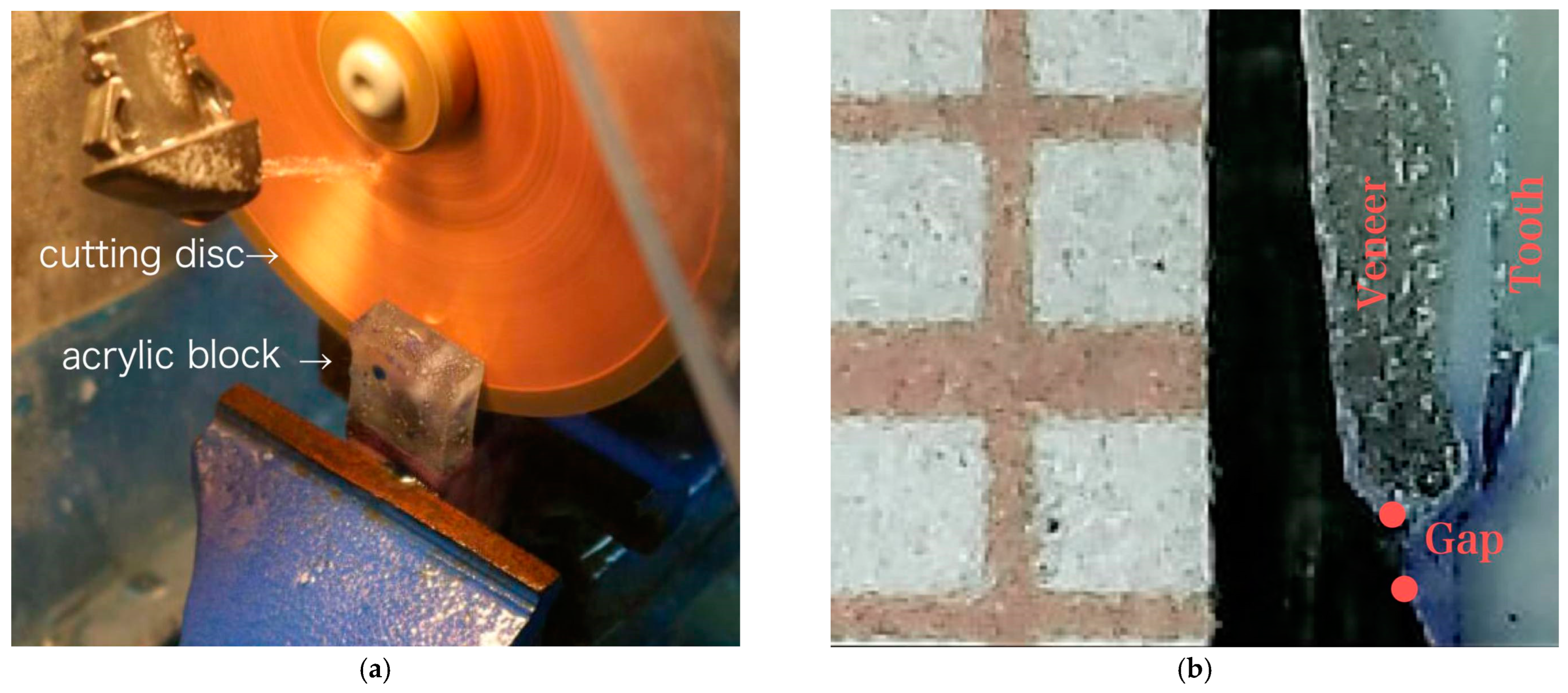 Dentistry 11 00012 g004 Dentistry 11 00012 g004