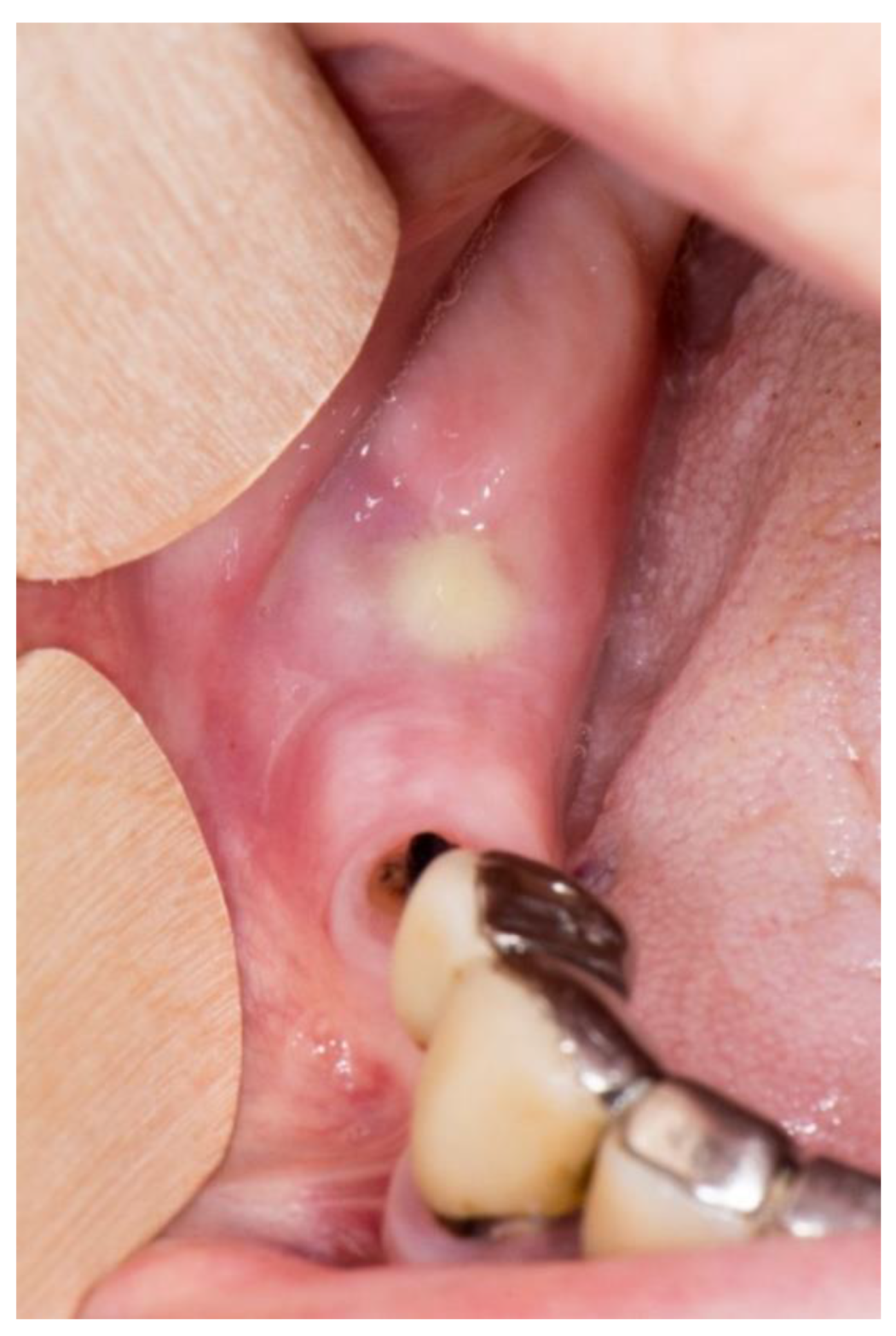 Dentistry 11 00023 g001