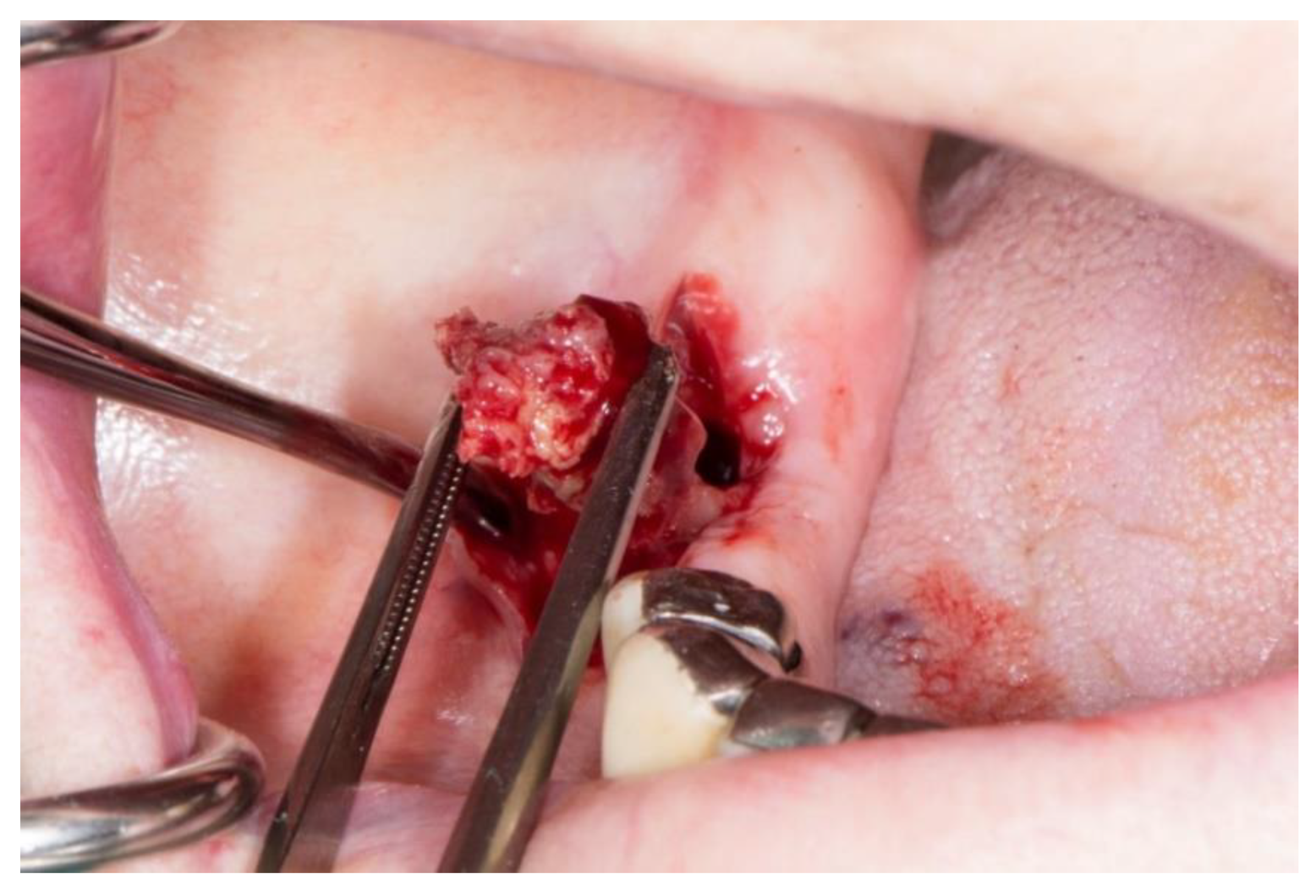 Dentistry 11 00023 g002