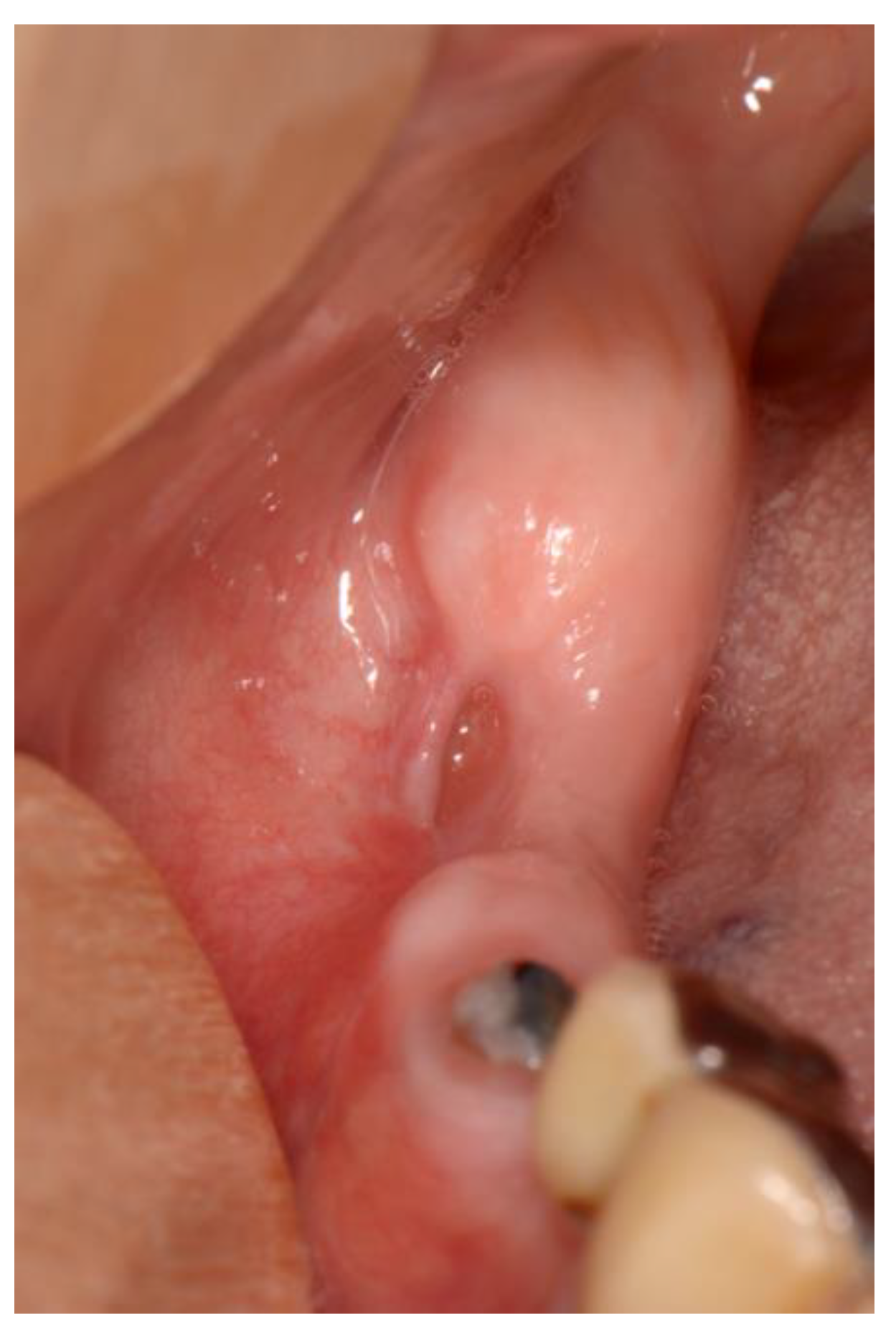 Dentistry 11 00023 g004