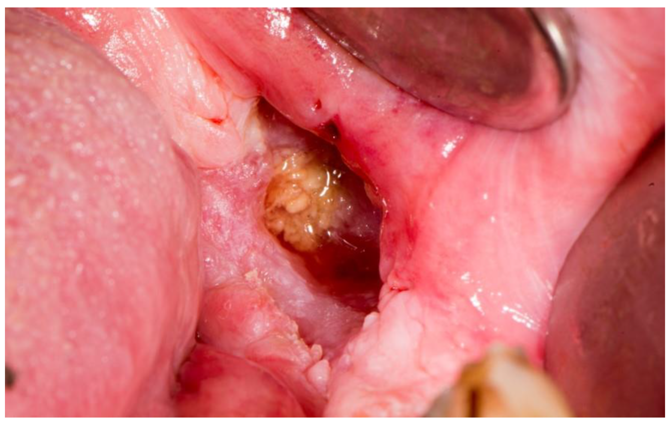 Dentistry 11 00023 g005