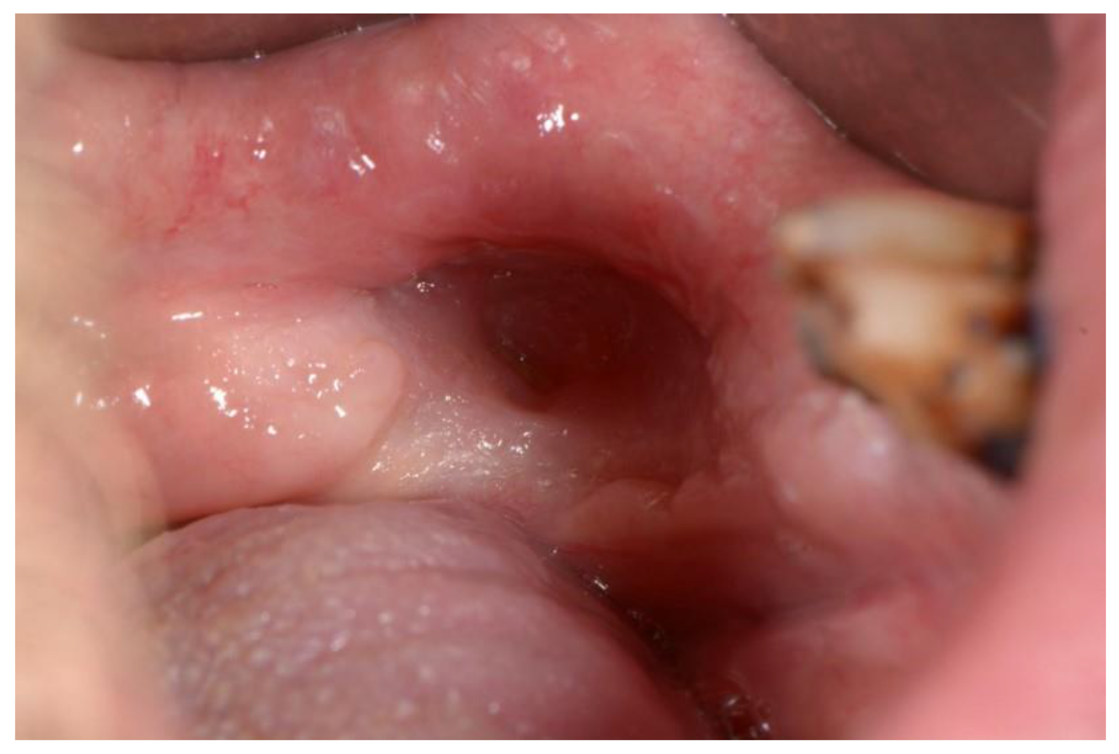 Dentistry 11 00023 g006