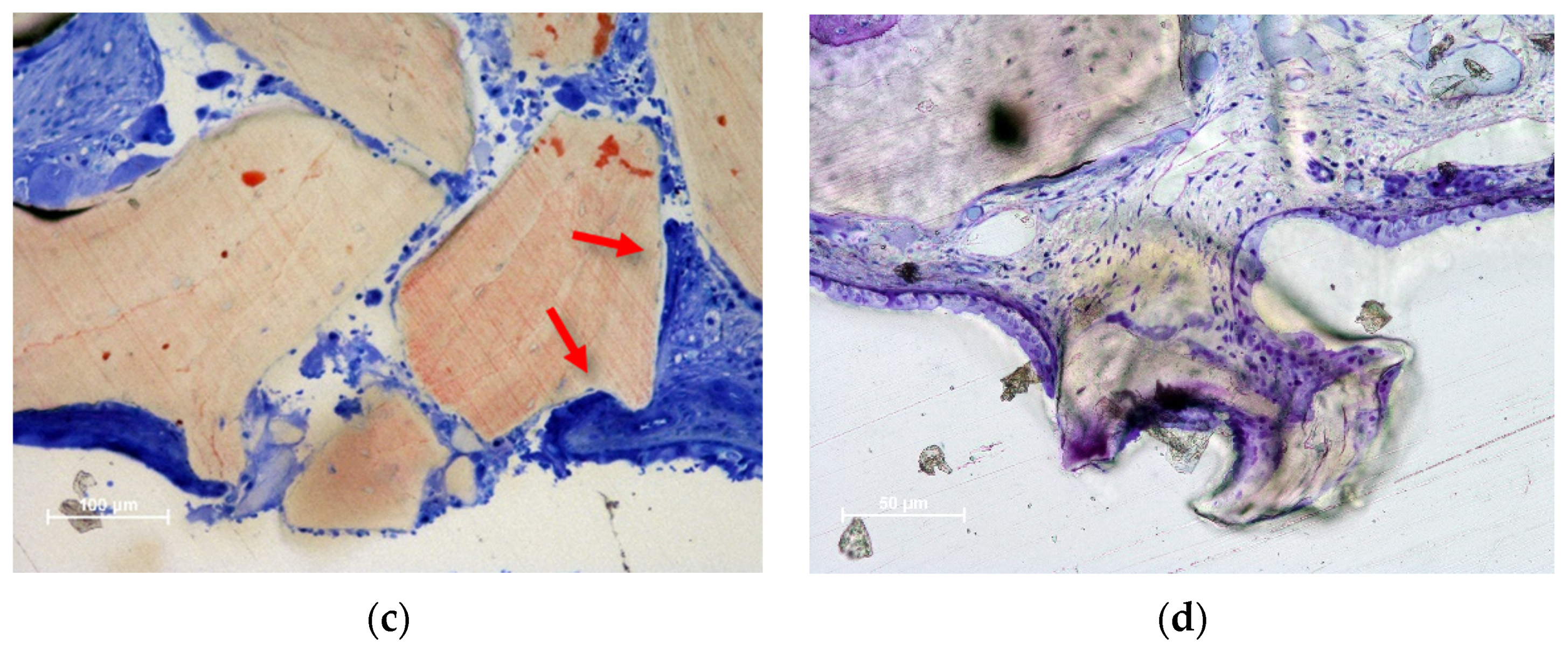 Dentistry 11 00031 g004b