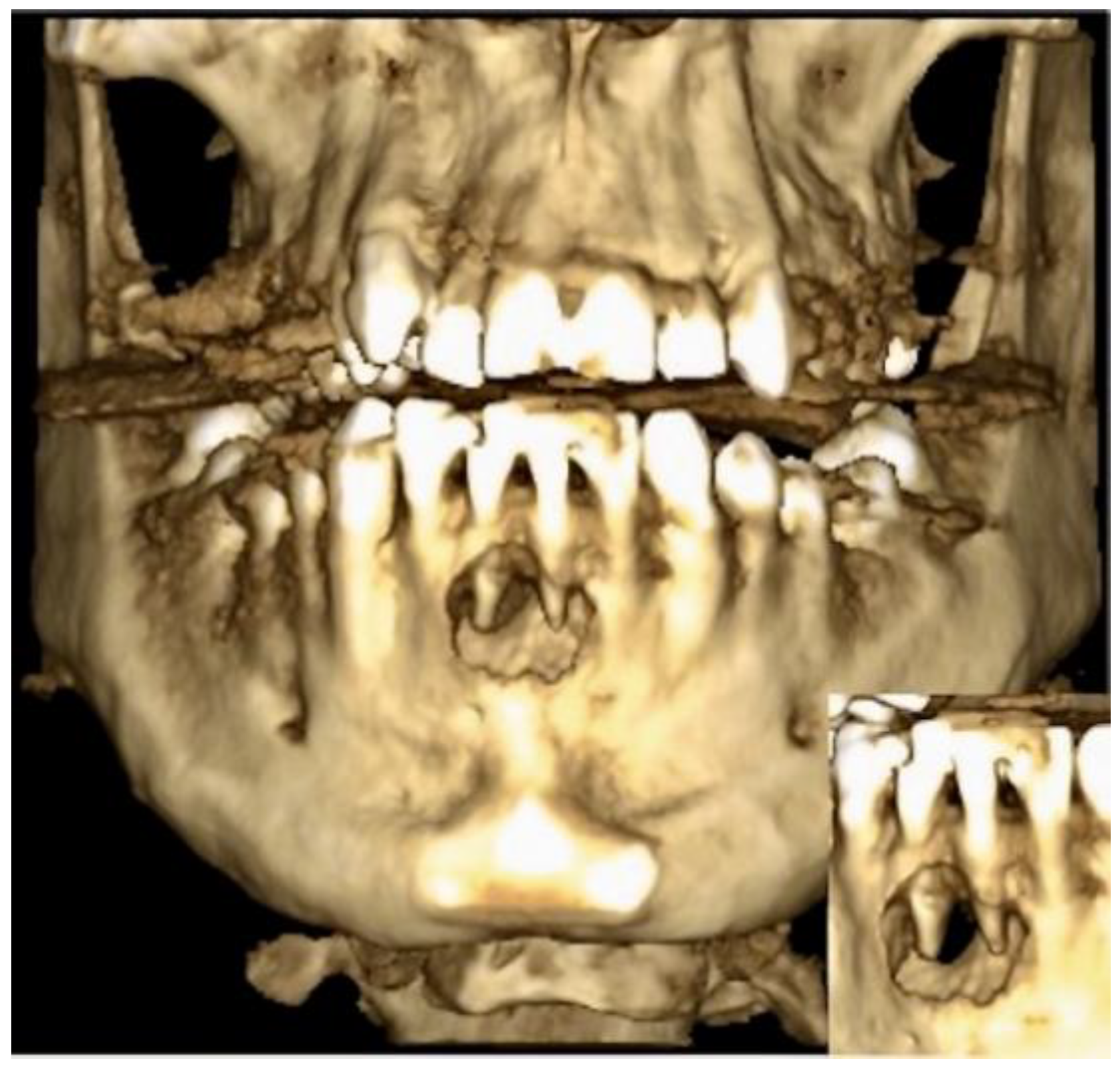 Dentistry 11 00037 g001 Dentistry 11 00037 g001