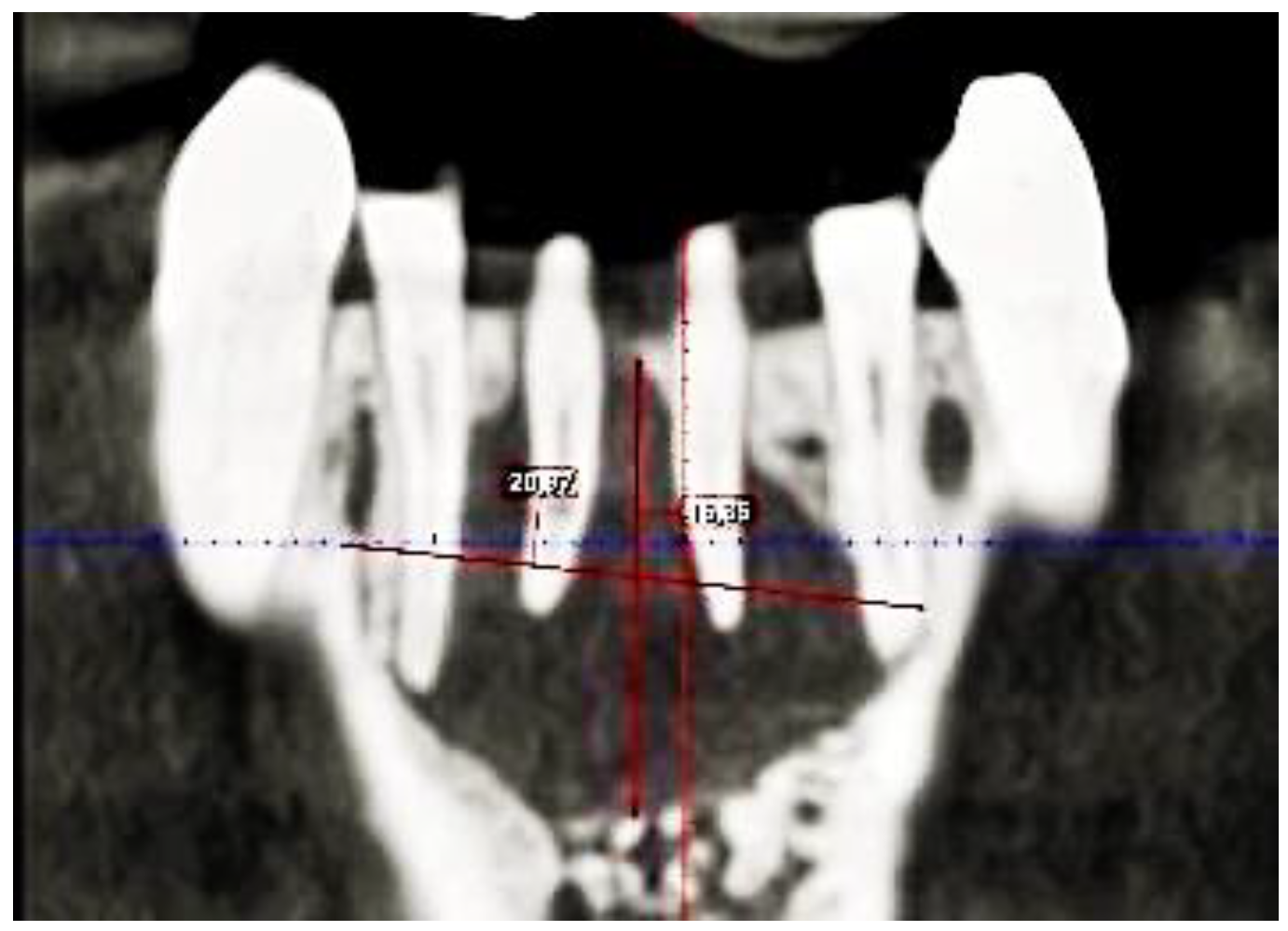 Dentistry 11 00037 g002 Dentistry 11 00037 g002