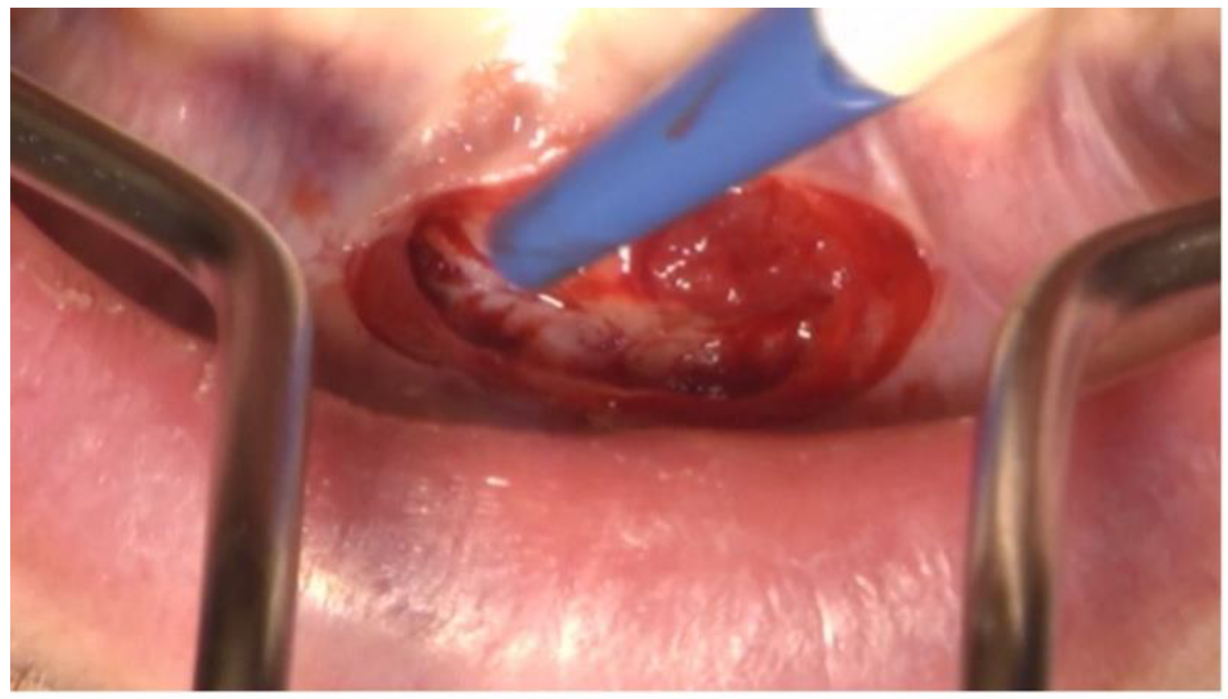 Dentistry 11 00037 g003 Dentistry 11 00037 g003