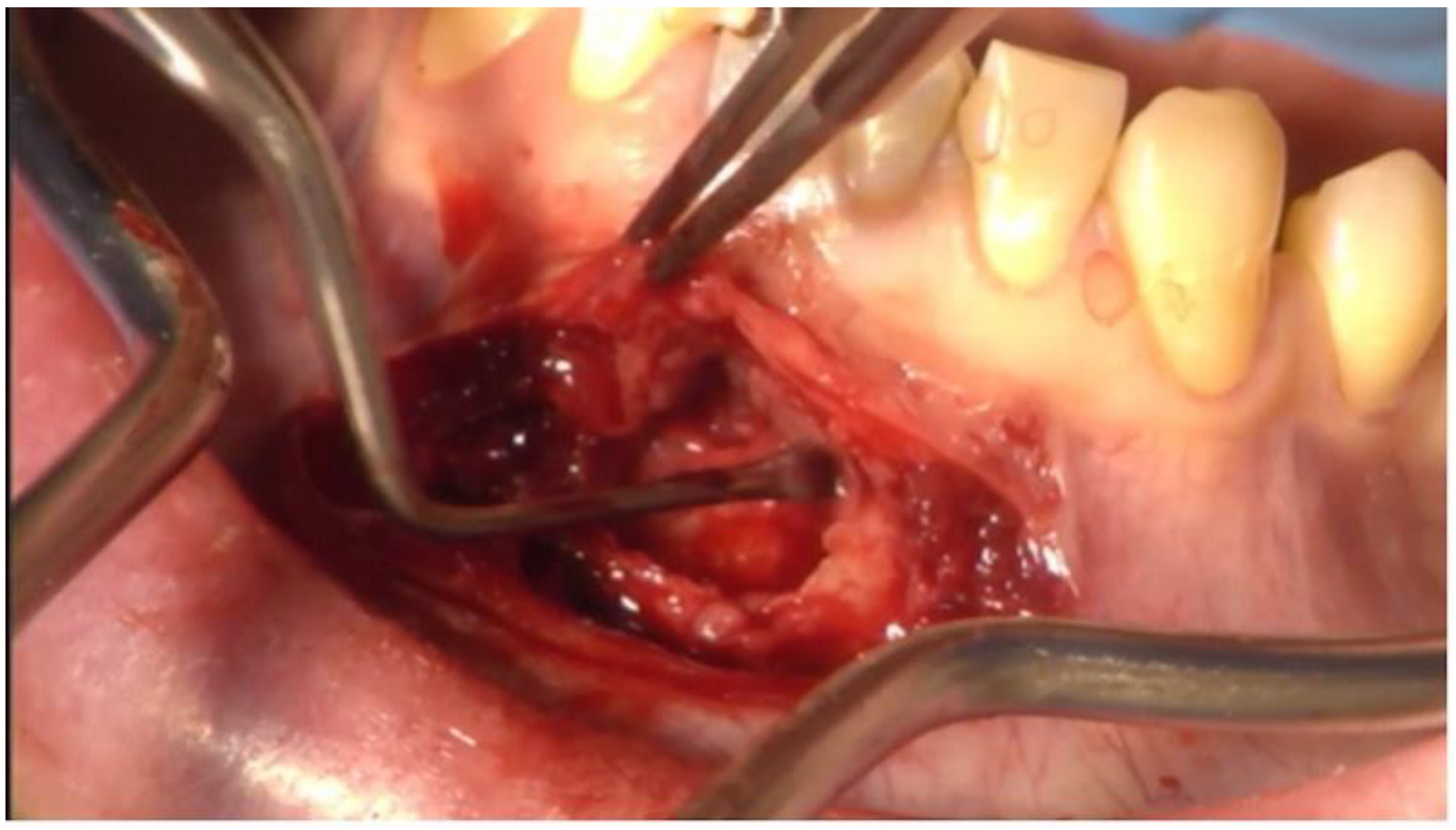 Dentistry 11 00037 g004 Dentistry 11 00037 g004