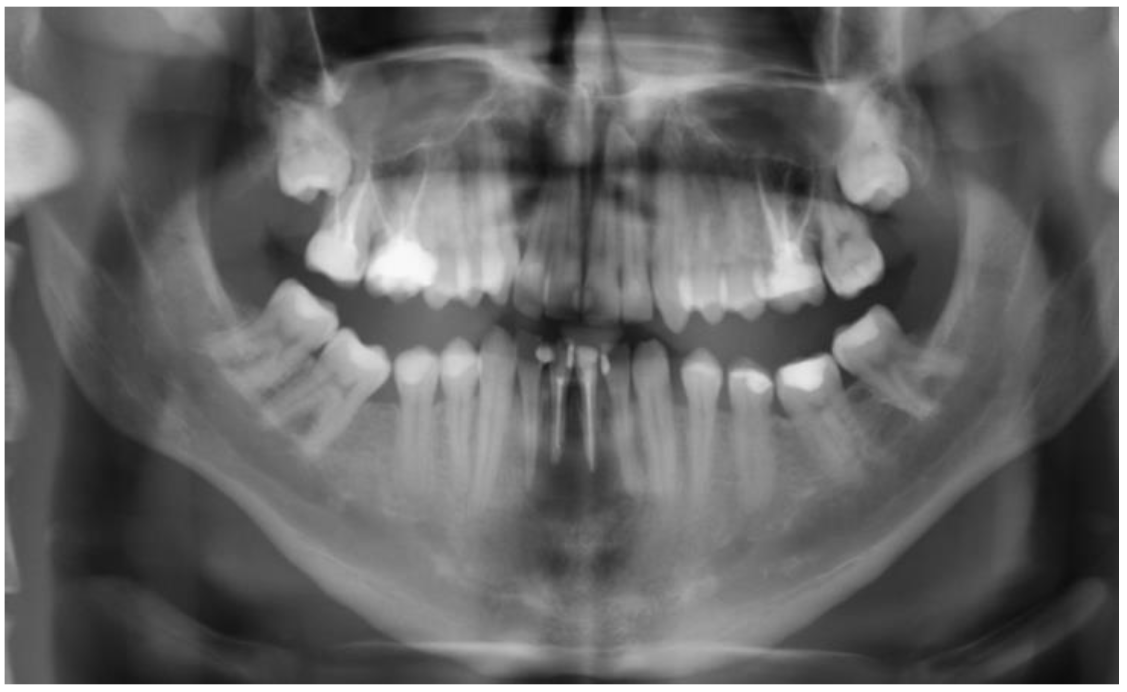 Dentistry 11 00037 g005 Dentistry 11 00037 g005