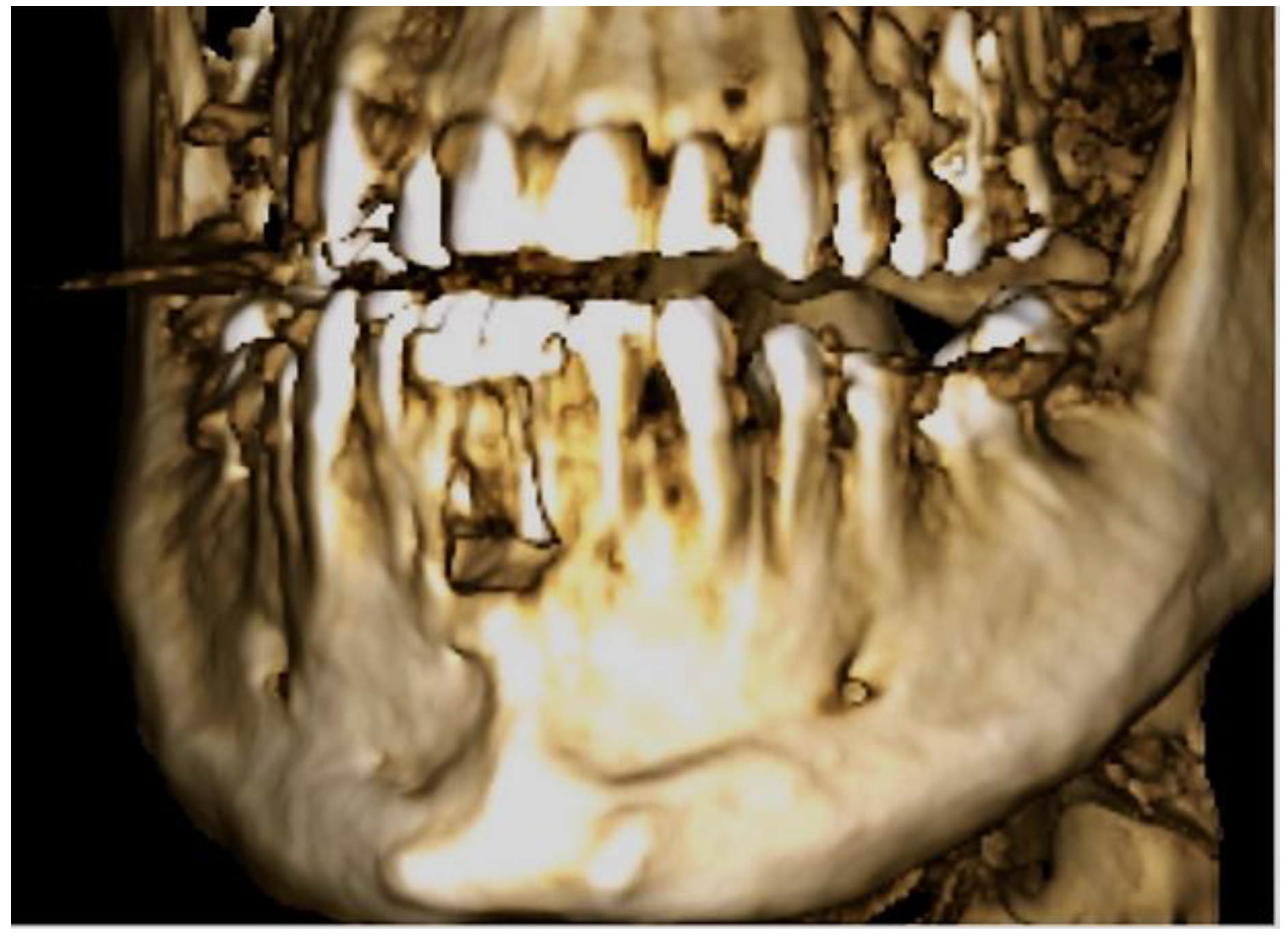 Dentistry 11 00037 g007 Dentistry 11 00037 g007