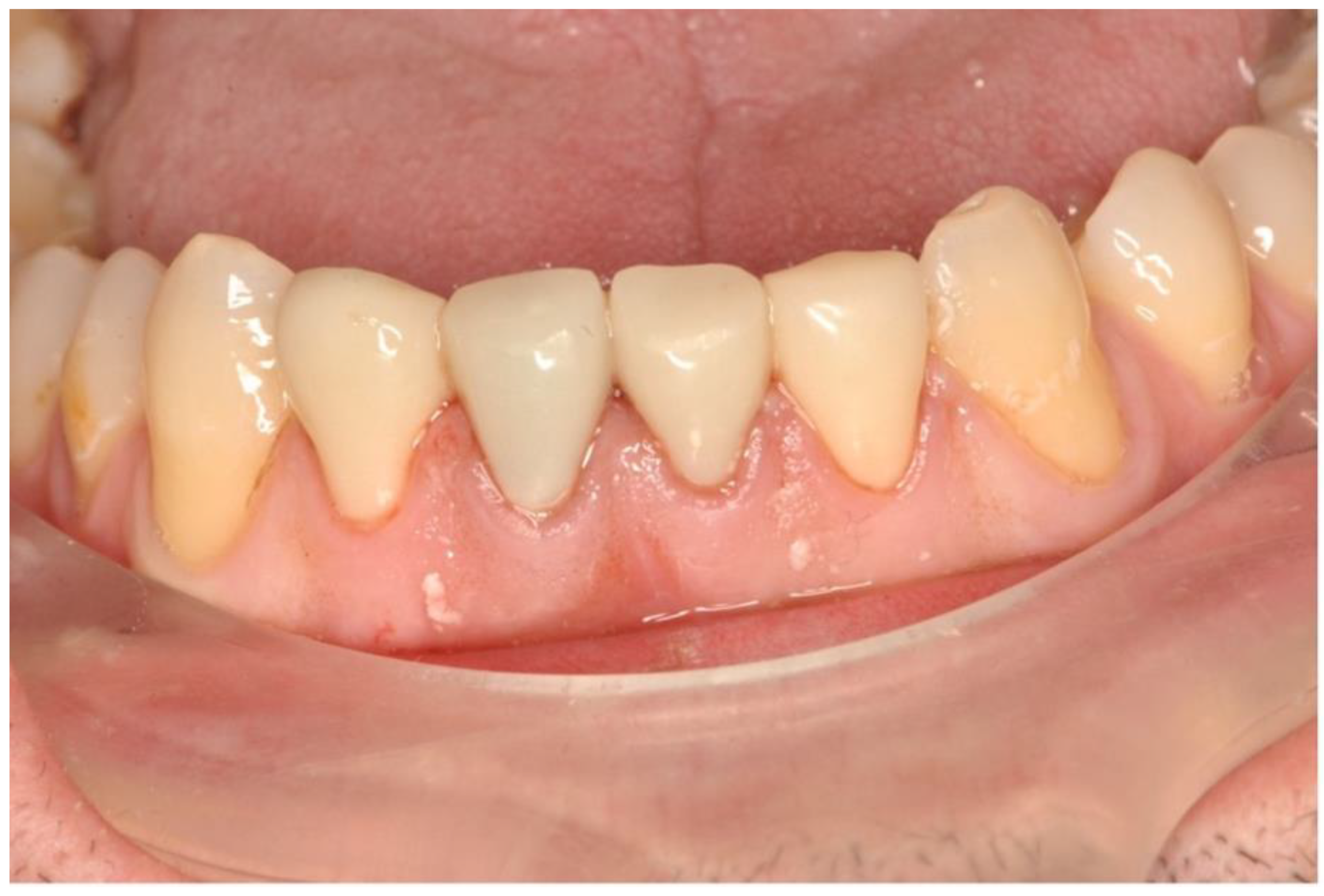 Dentistry 11 00037 g008 Dentistry 11 00037 g008