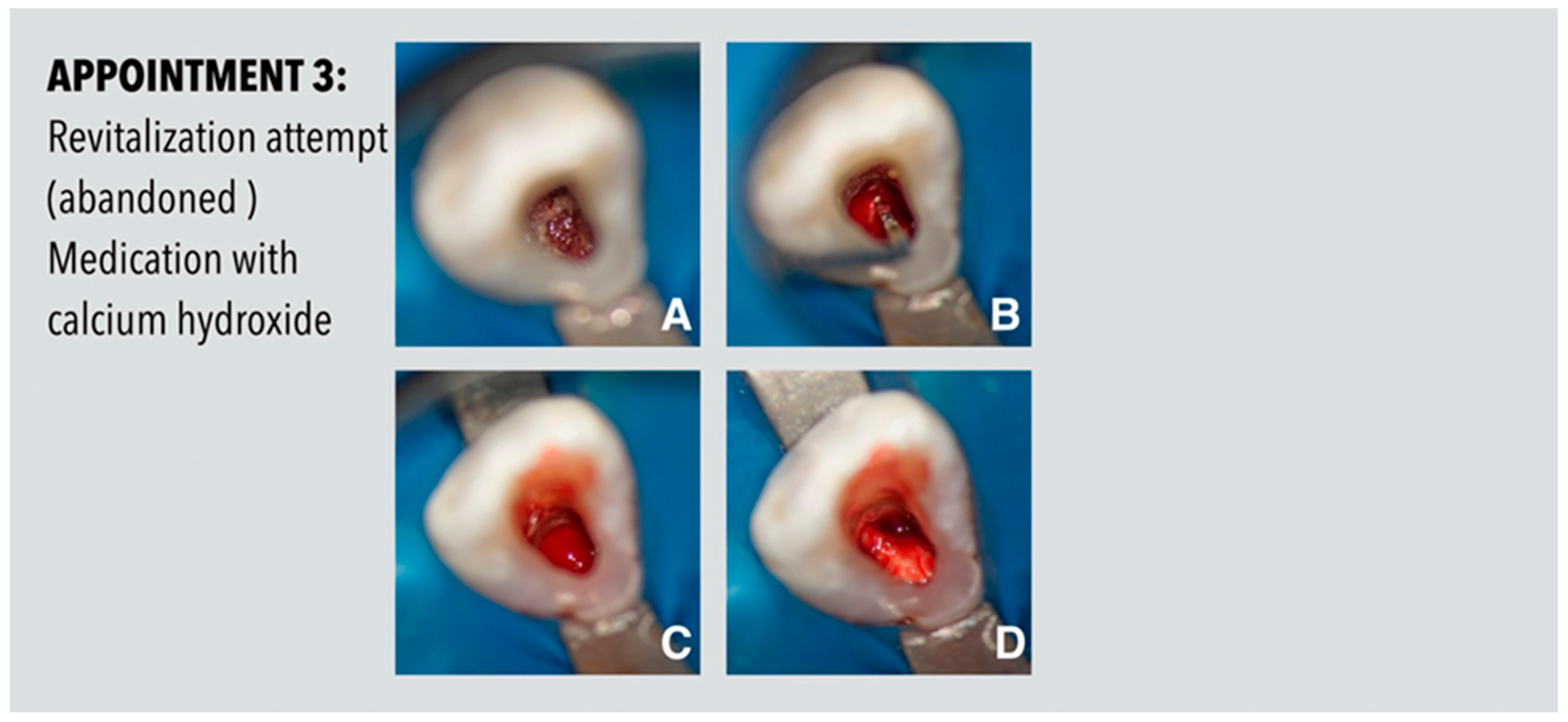 Dentistry 11 00047 g003 Dentistry 11 00047 g003