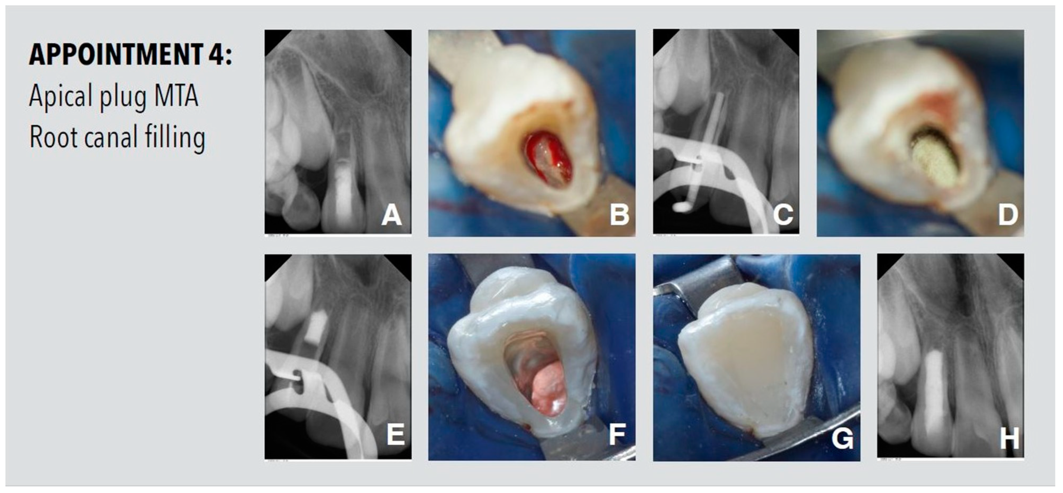 Dentistry 11 00047 g004 Dentistry 11 00047 g004