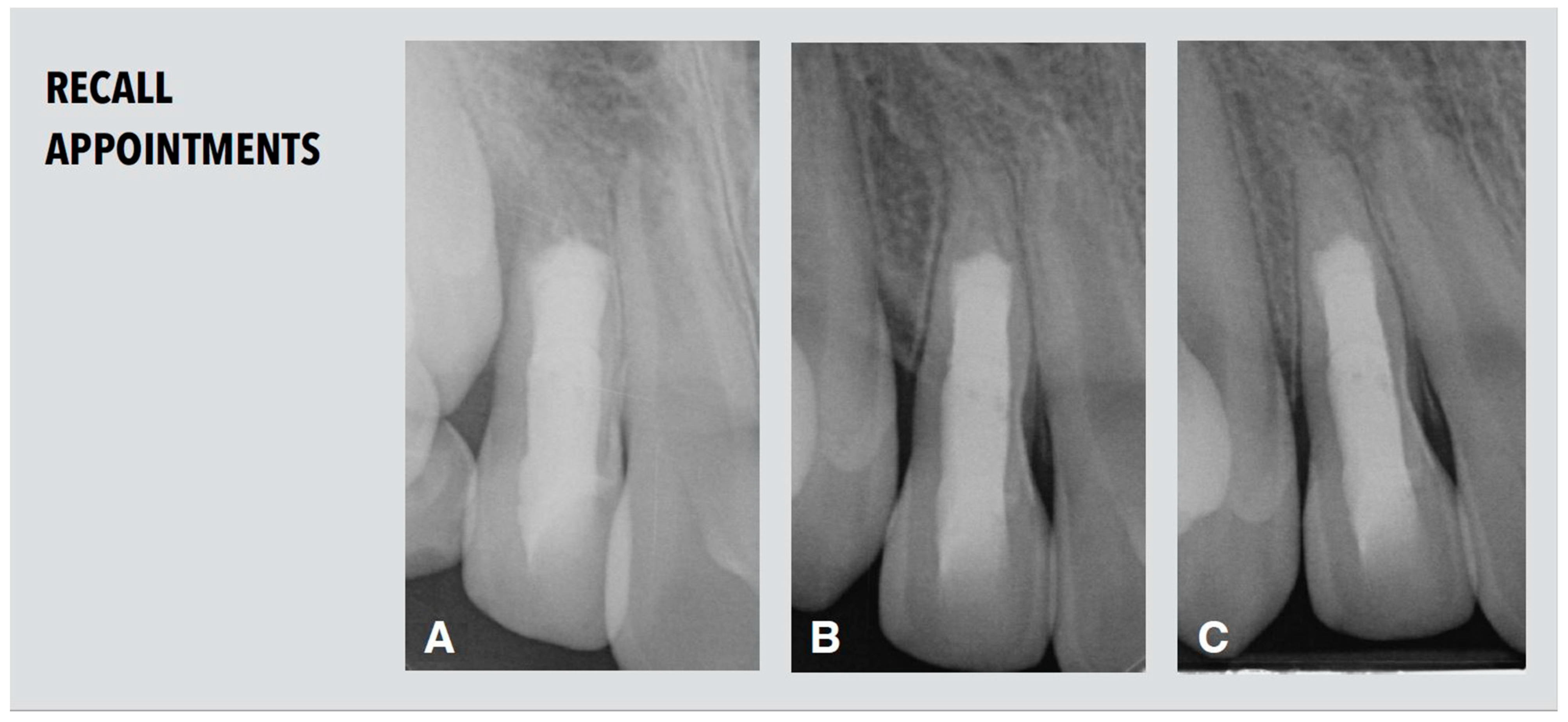 Dentistry 11 00047 g005 Dentistry 11 00047 g005