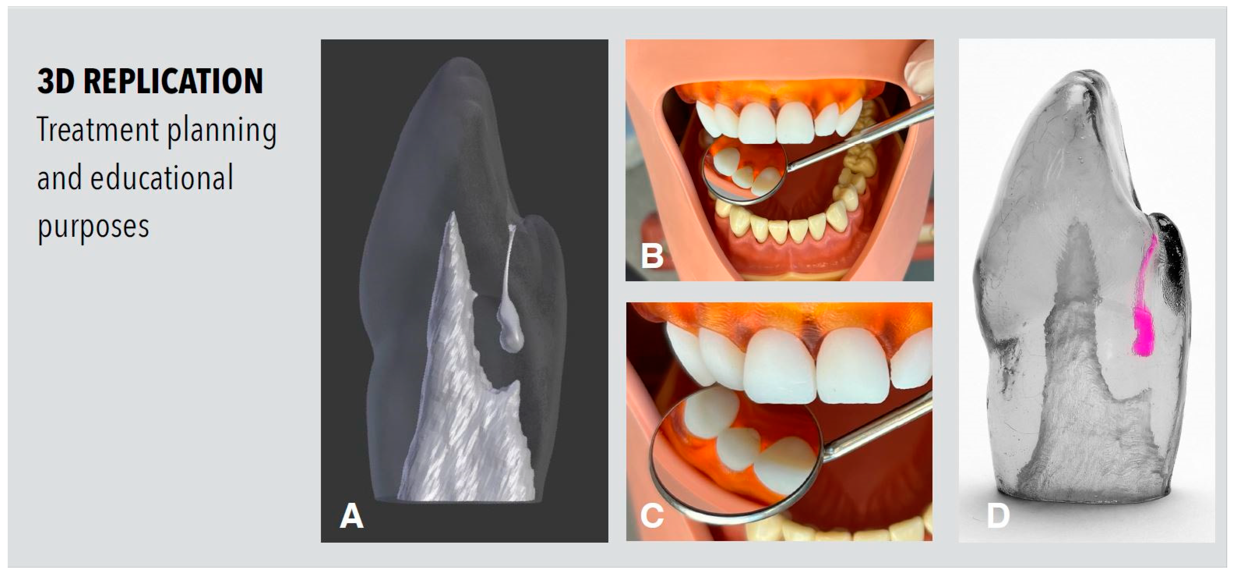 Dentistry 11 00047 g006 Dentistry 11 00047 g006