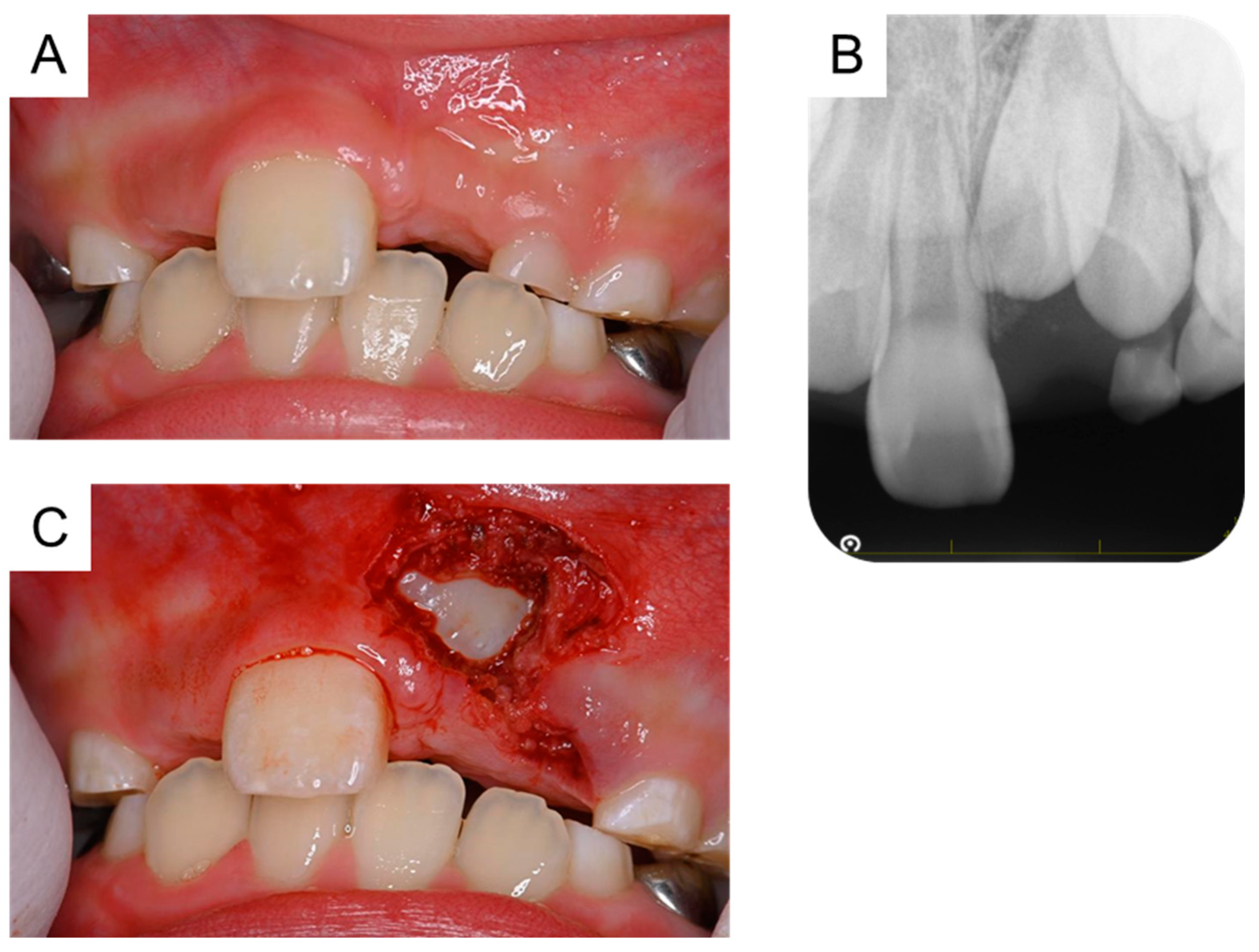 Dentistry 11 00049 g005 550