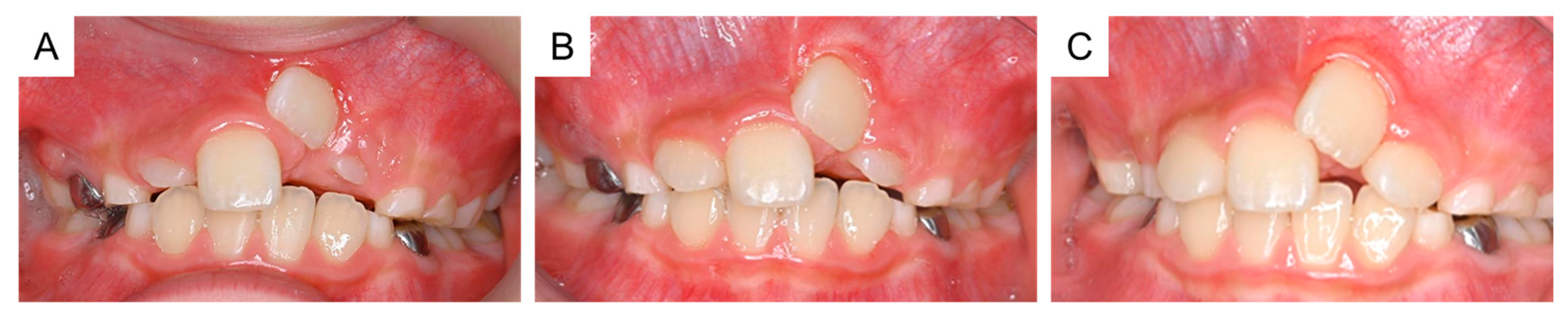 Dentistry 11 00049 g006 550