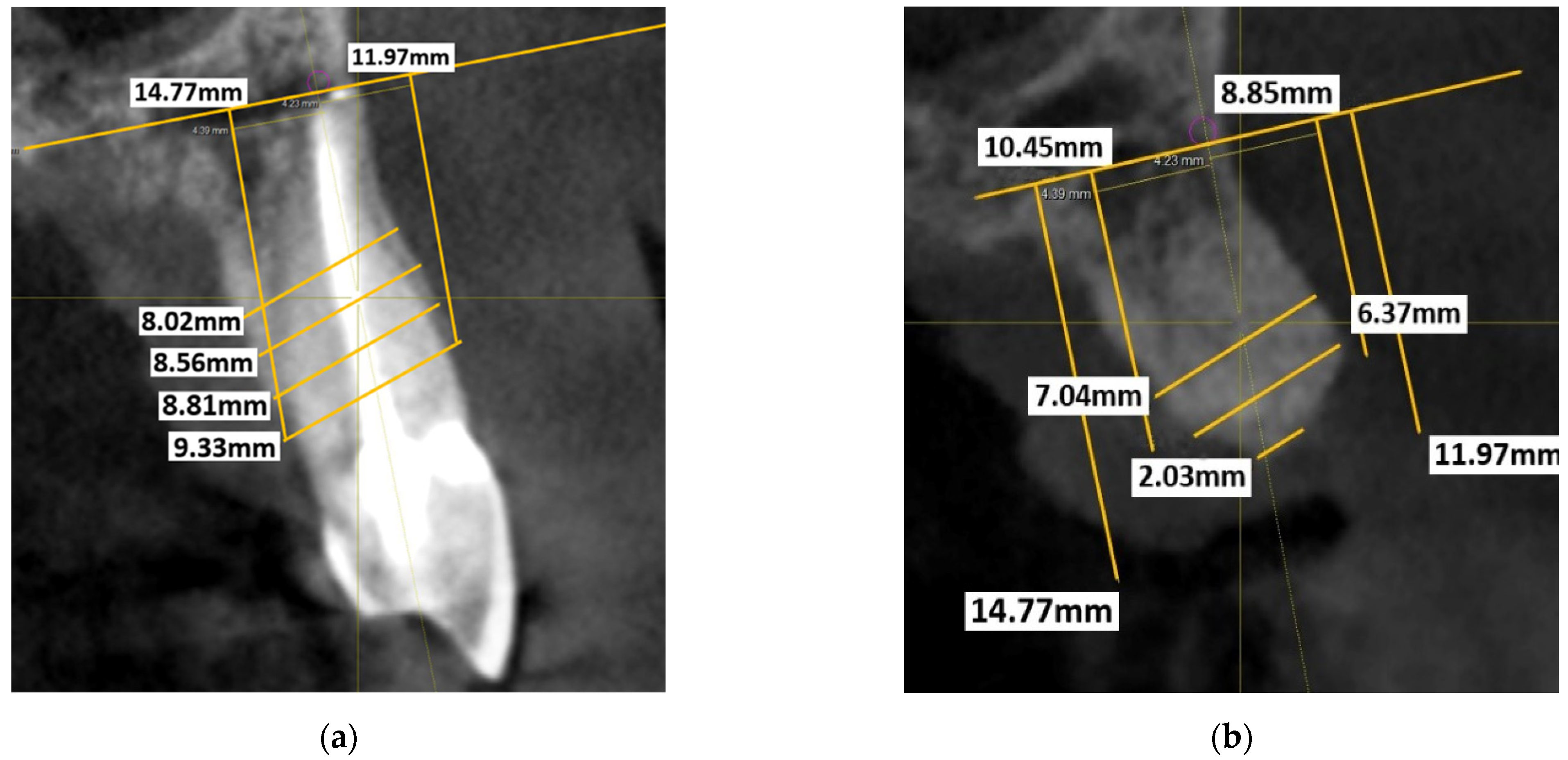 Dentistry 11 00058 g001