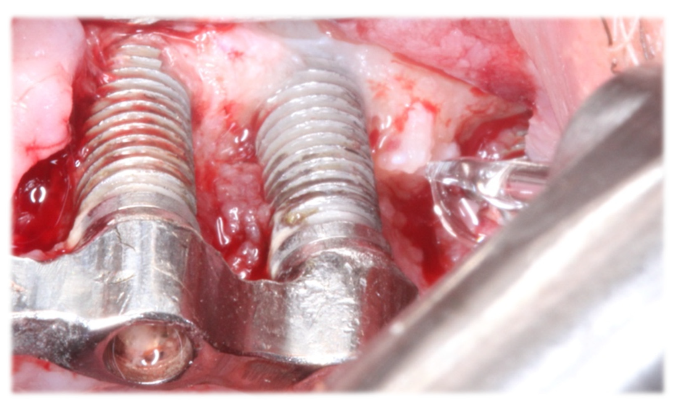 Dentistry 11 00061 g002